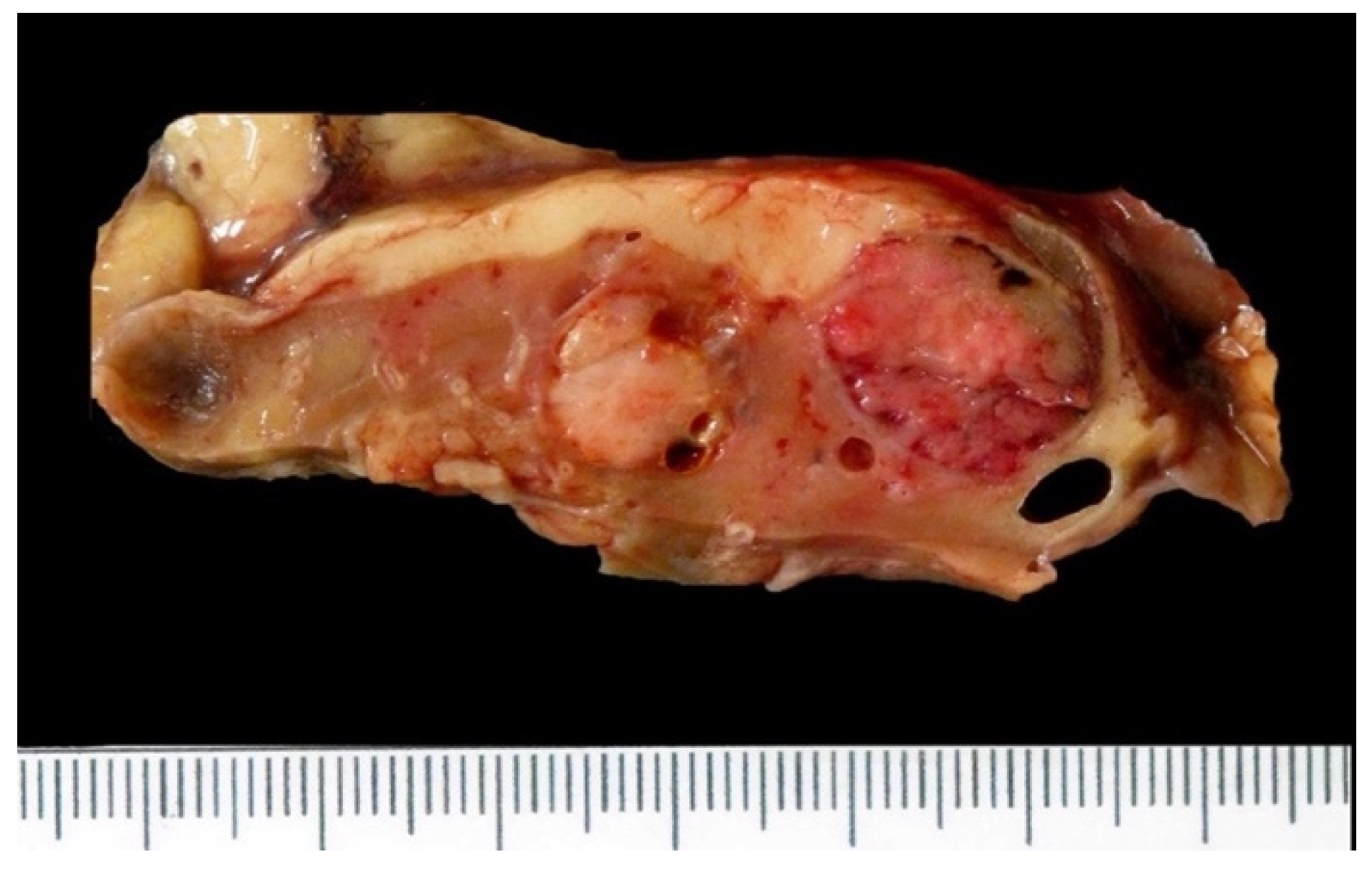 Biomedicines 10 00657 g002 Biomedicines 10 00657 g002