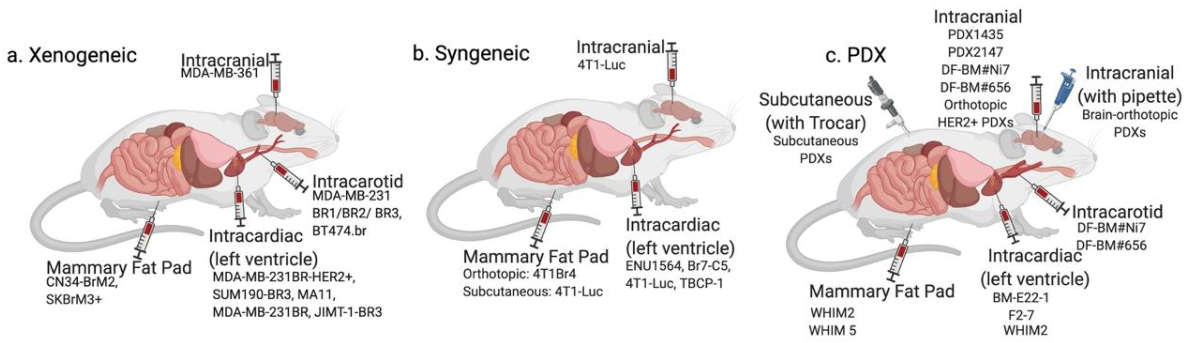 Preclinical Models of Brain Metastases in Breast Cancer