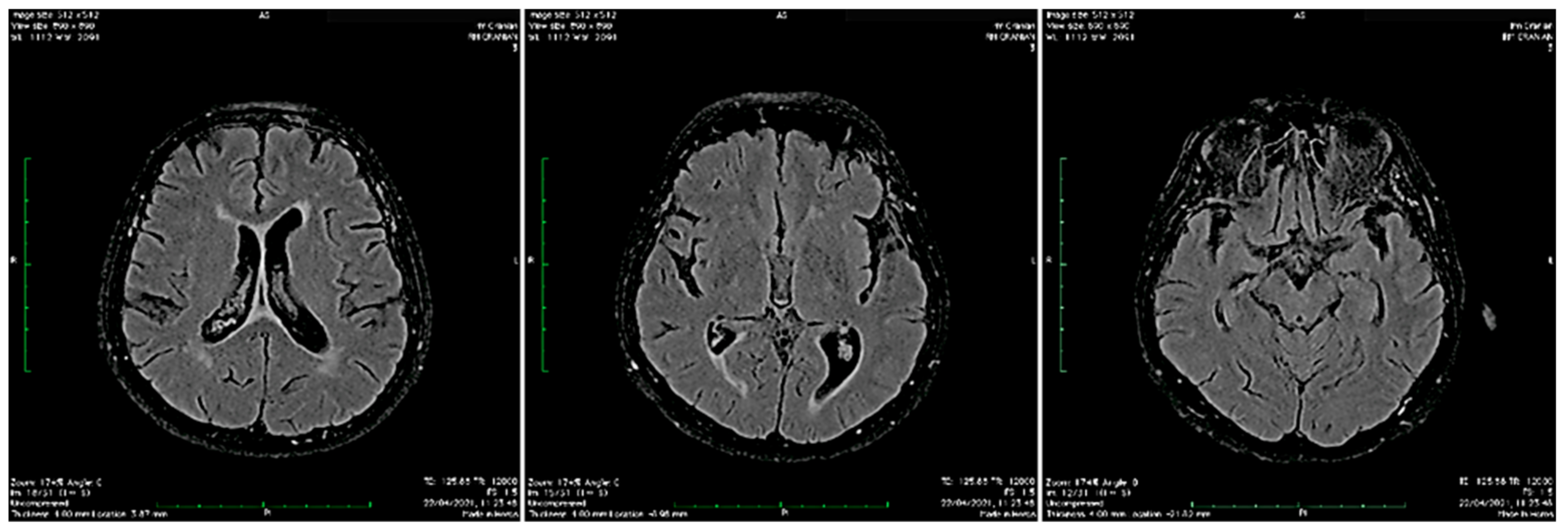 Biomedicines 10 00774 g002 550