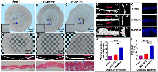 HREM, RNAseq and Cell Cycle Analyses Reveal the Role of the