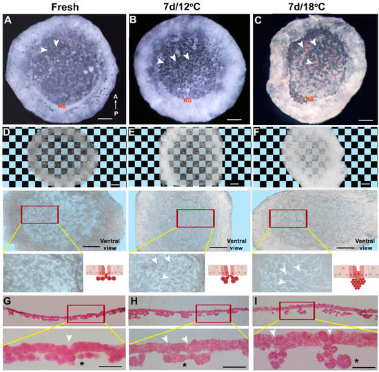 HREM, RNAseq and Cell Cycle Analyses Reveal the Role of the G2/M