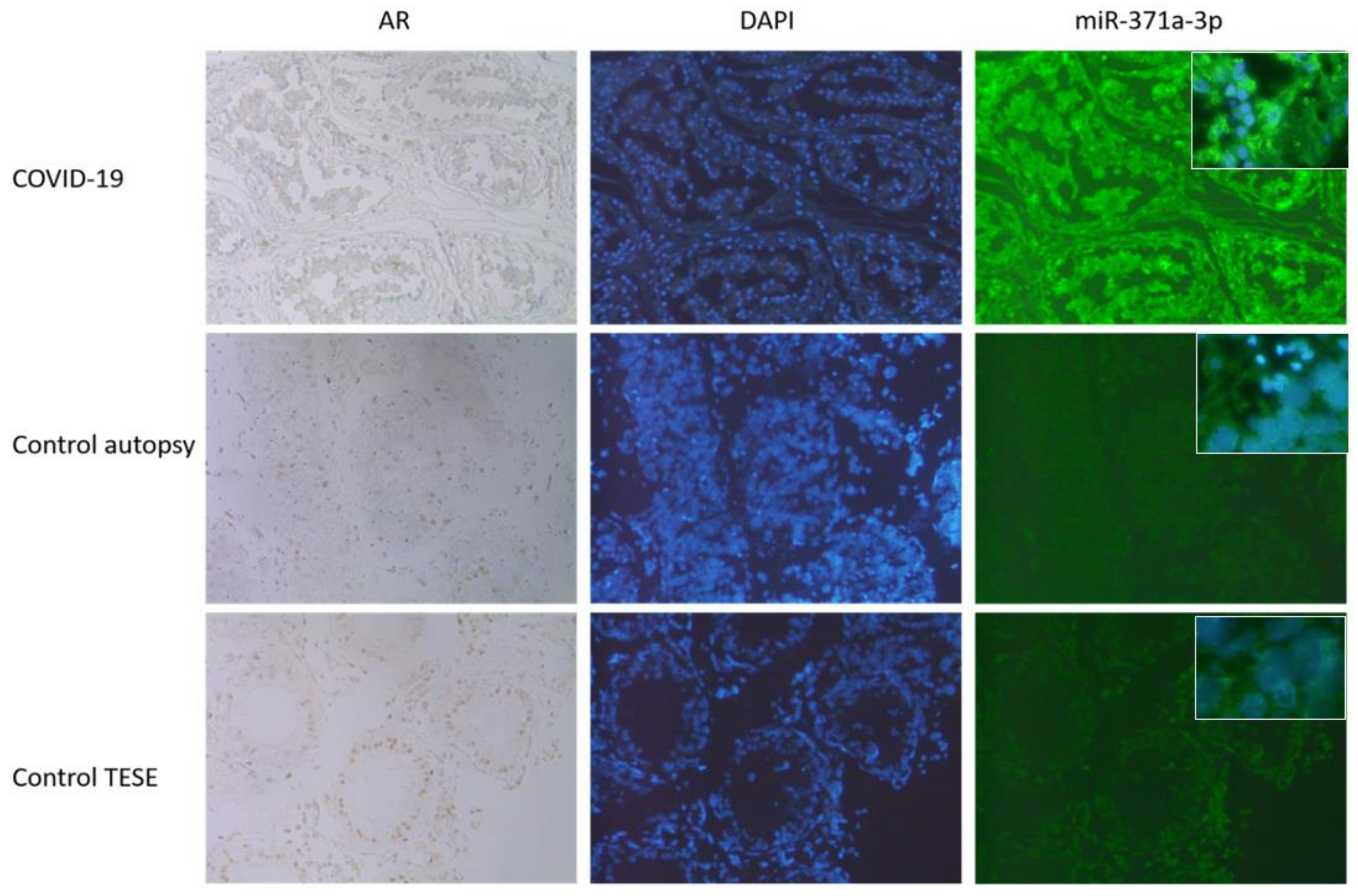 Biomedicines 10 00858 g004