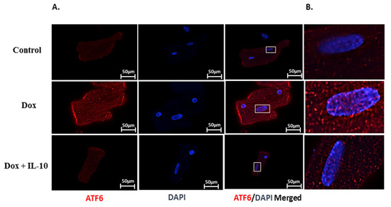 アンチ Interleukin-10 Mitigates Doxorubicin-Induced Endoplasmic