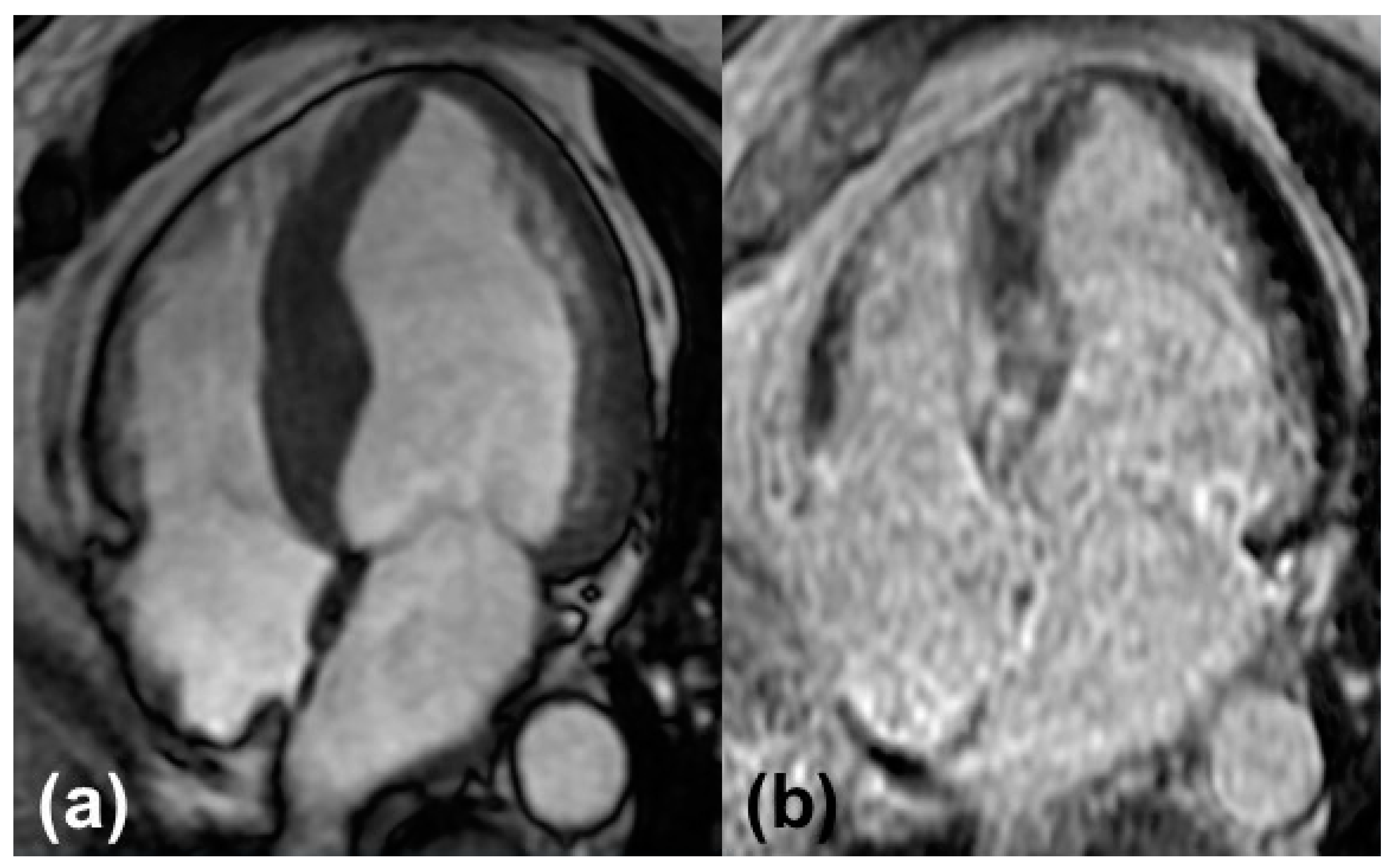 Biomedicines 10 00903 g002 550