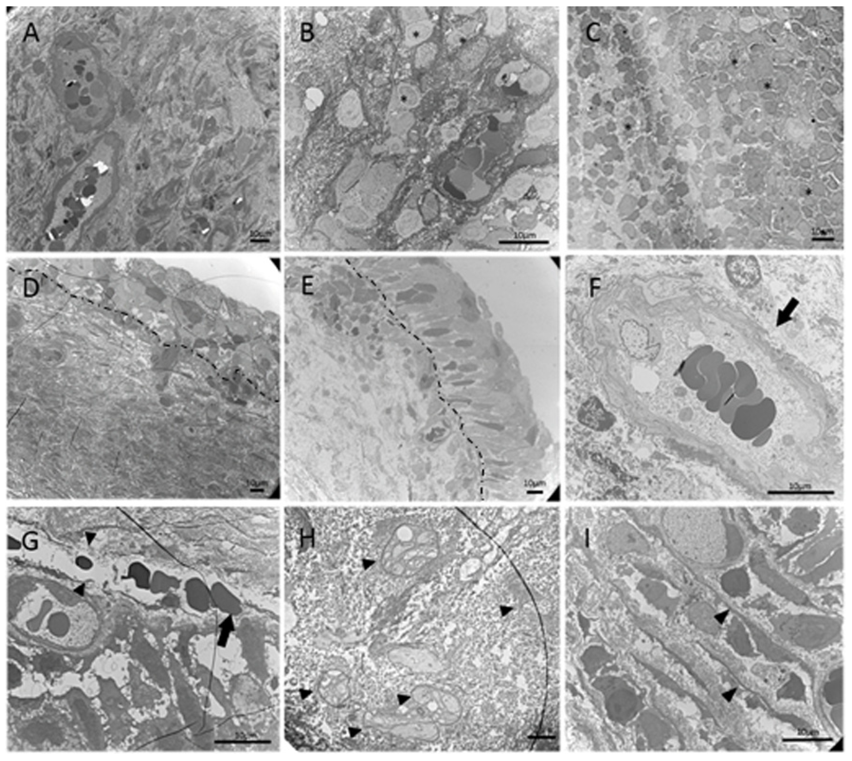 Biomedicines 10 01055 g002 550