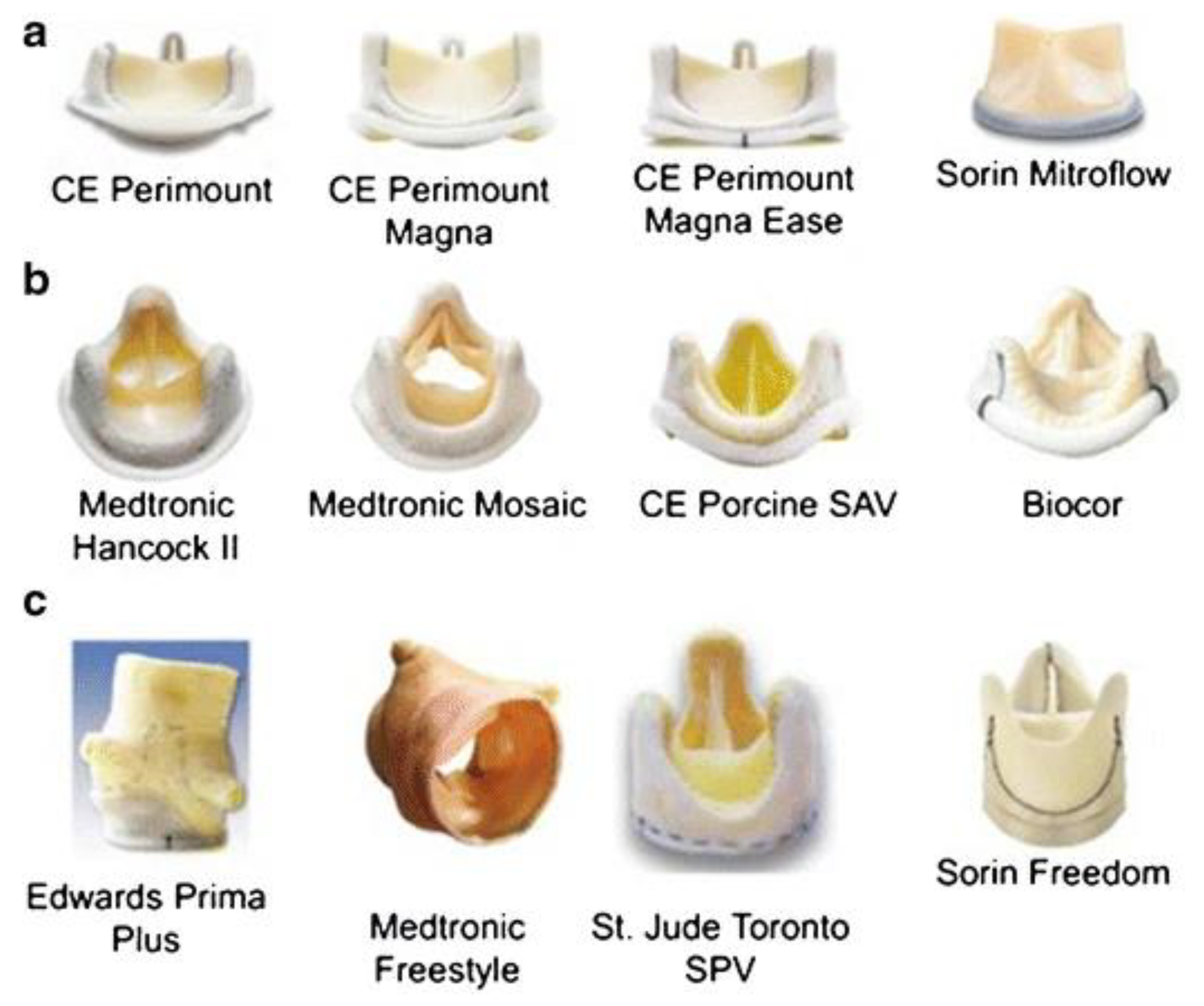 Tissue Heart Valve tissue-heart-valve