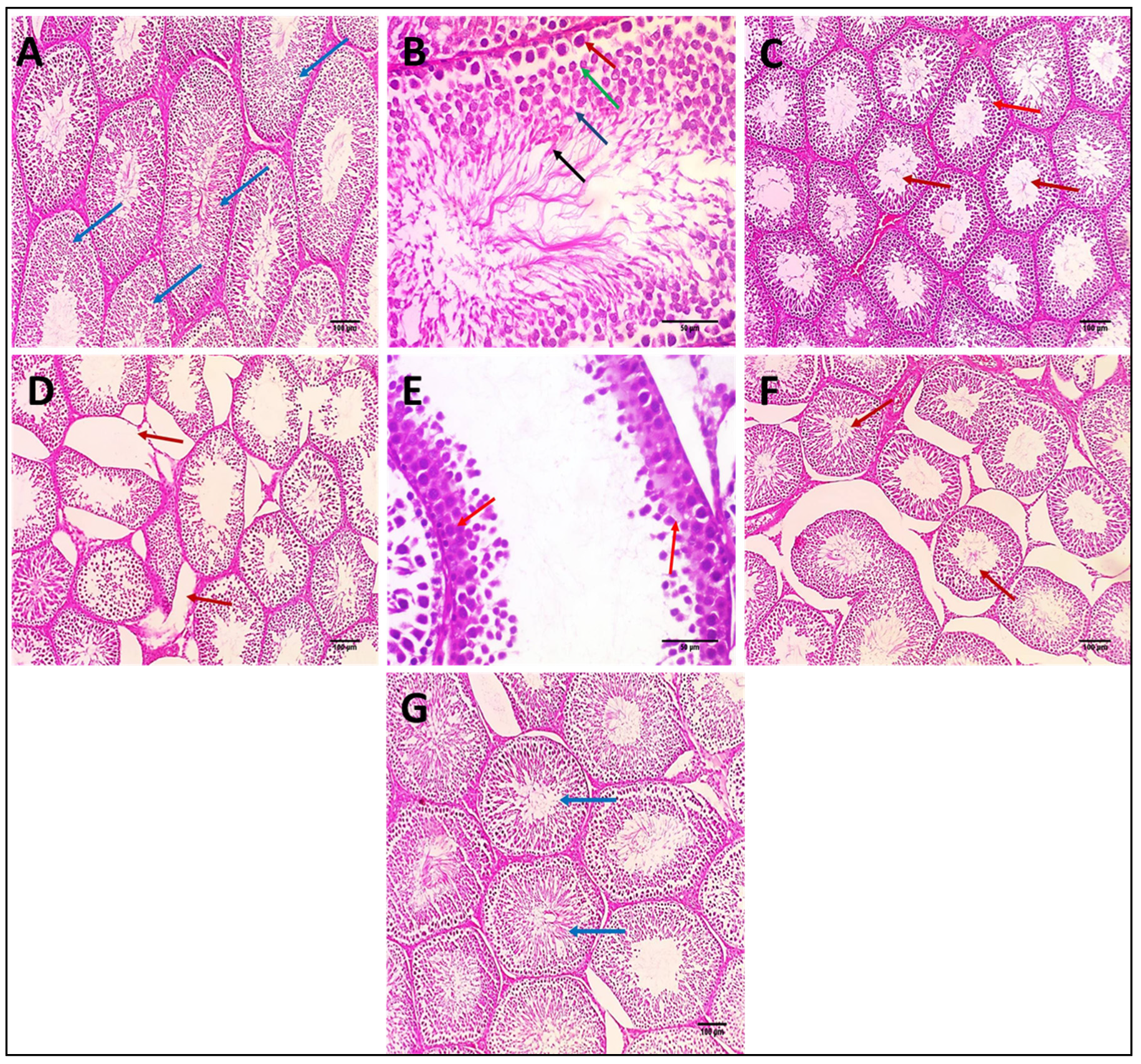 Biomedicines 10 01134 g006 550