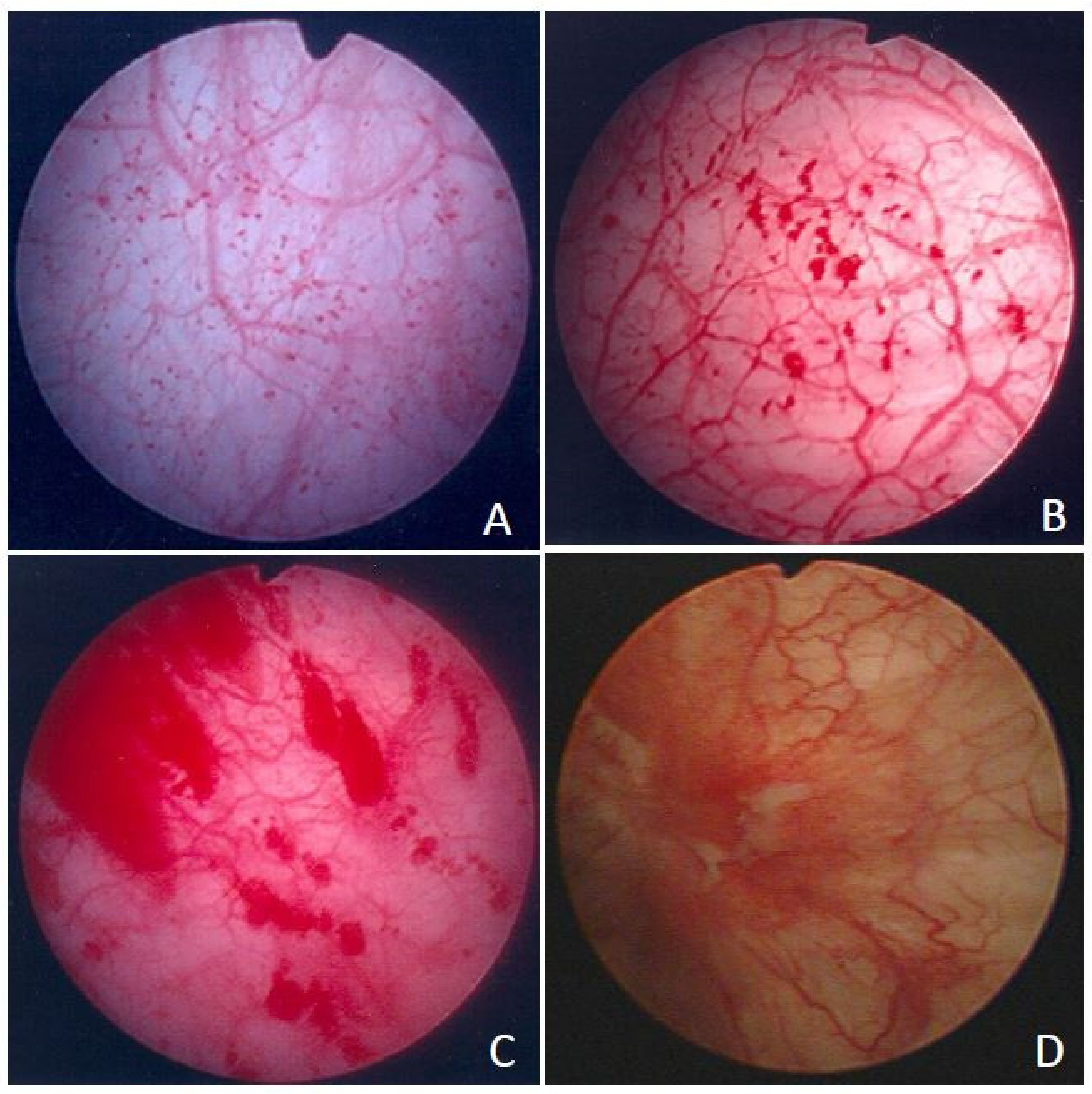 Biomedicines 10 01149 g001 Biomedicines 10 01149 g001