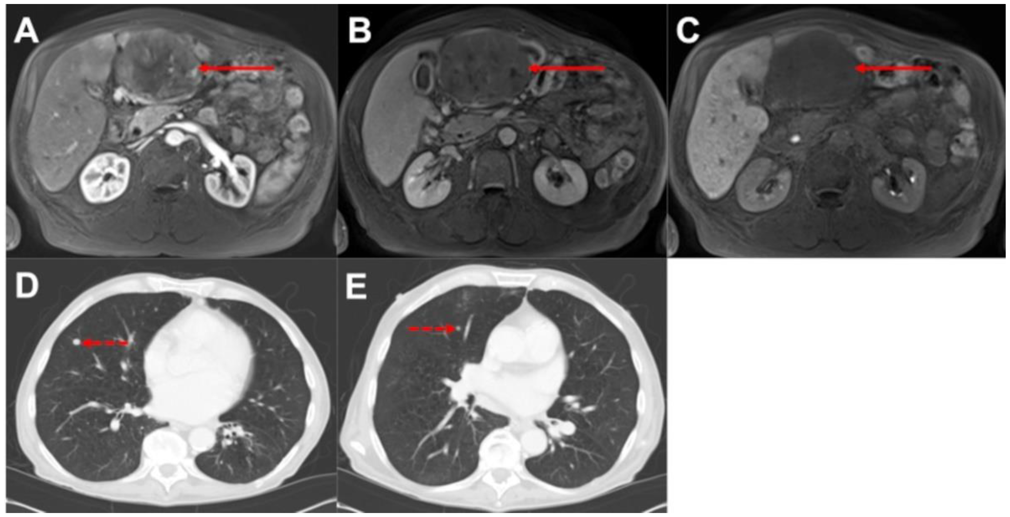 Biomedicines 10 01156 g002 550
