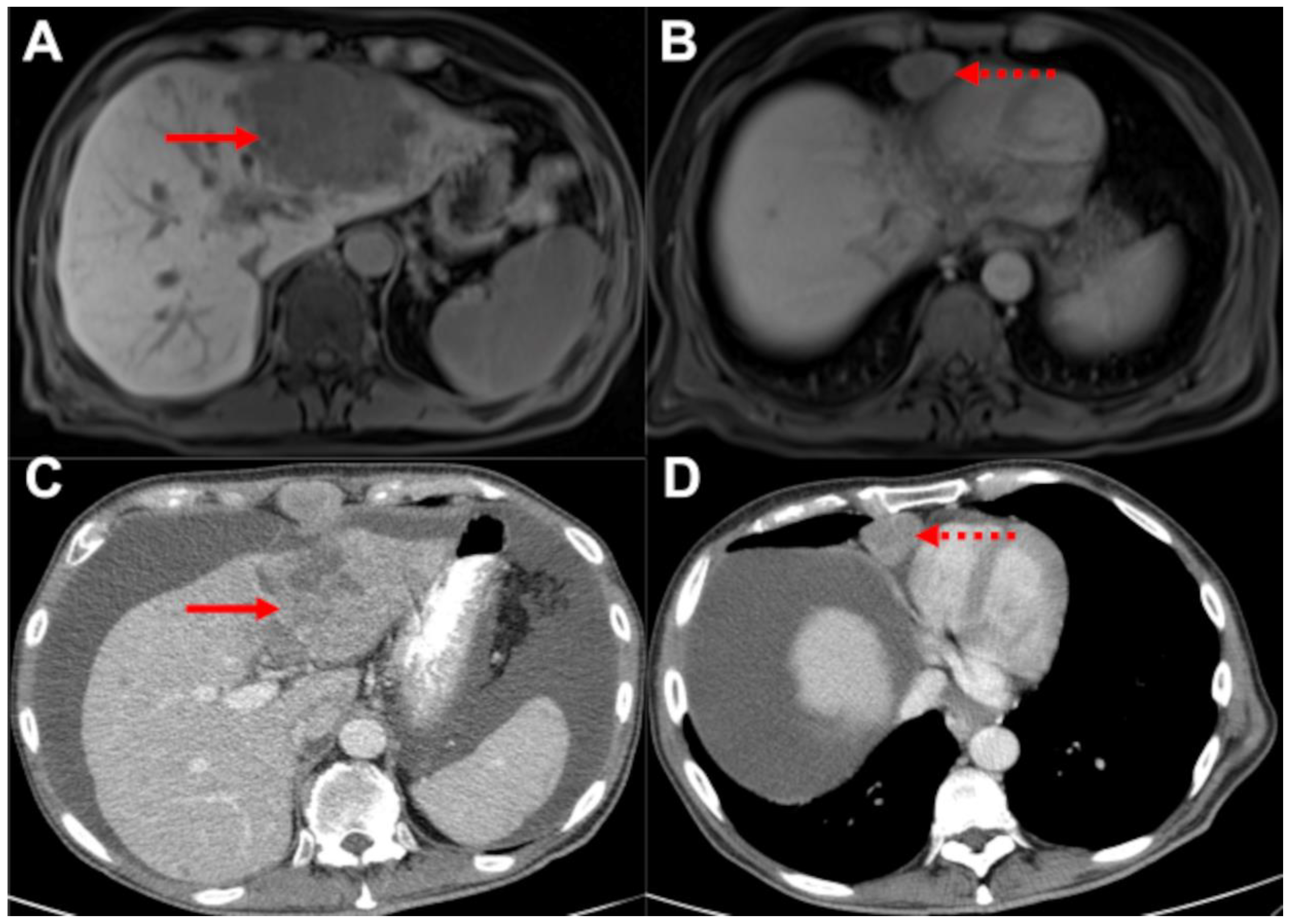 Biomedicines 10 01156 g003 550