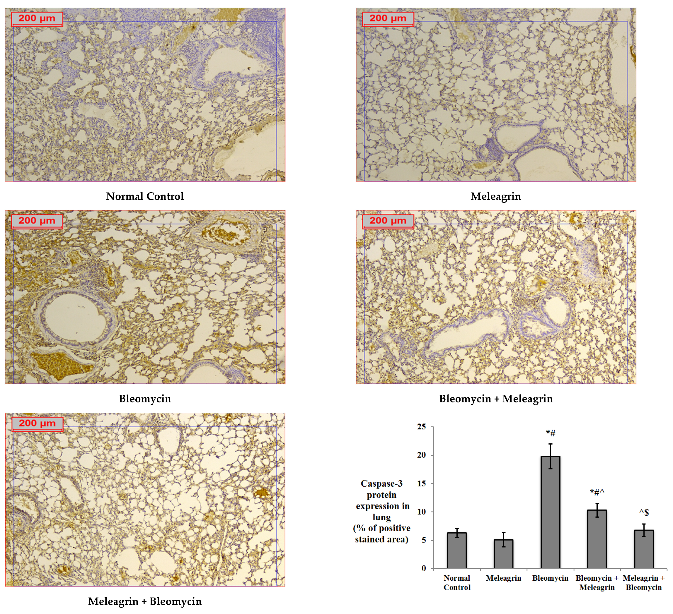 Biomedicines 10 01164 g006