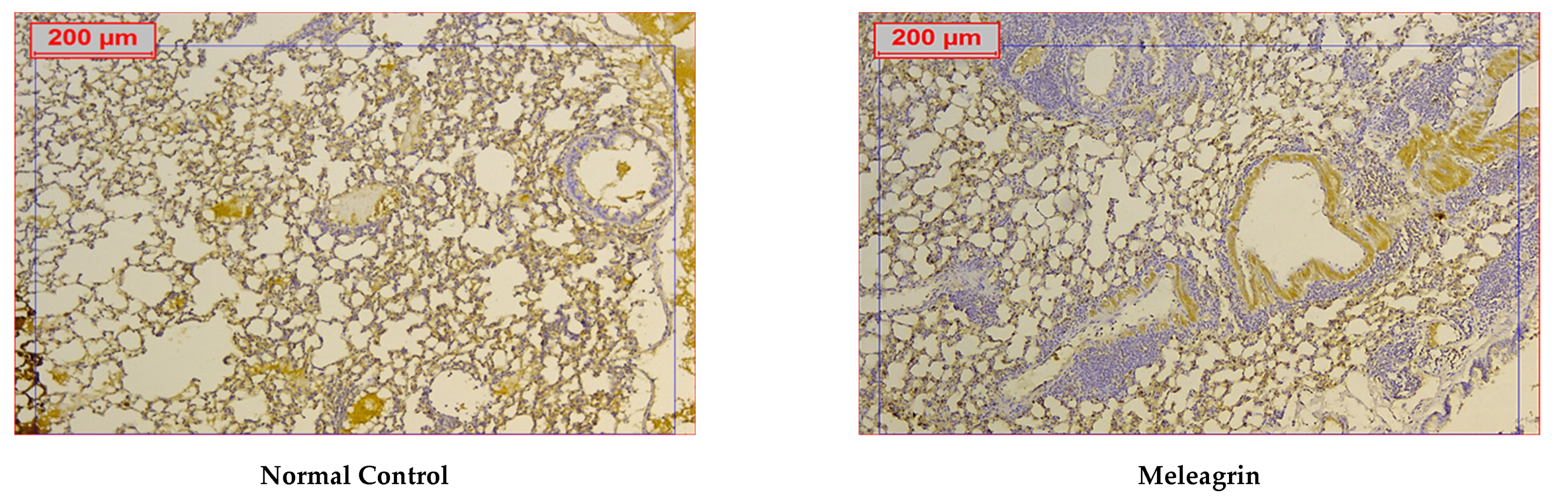 Biomedicines 10 01164 g007a