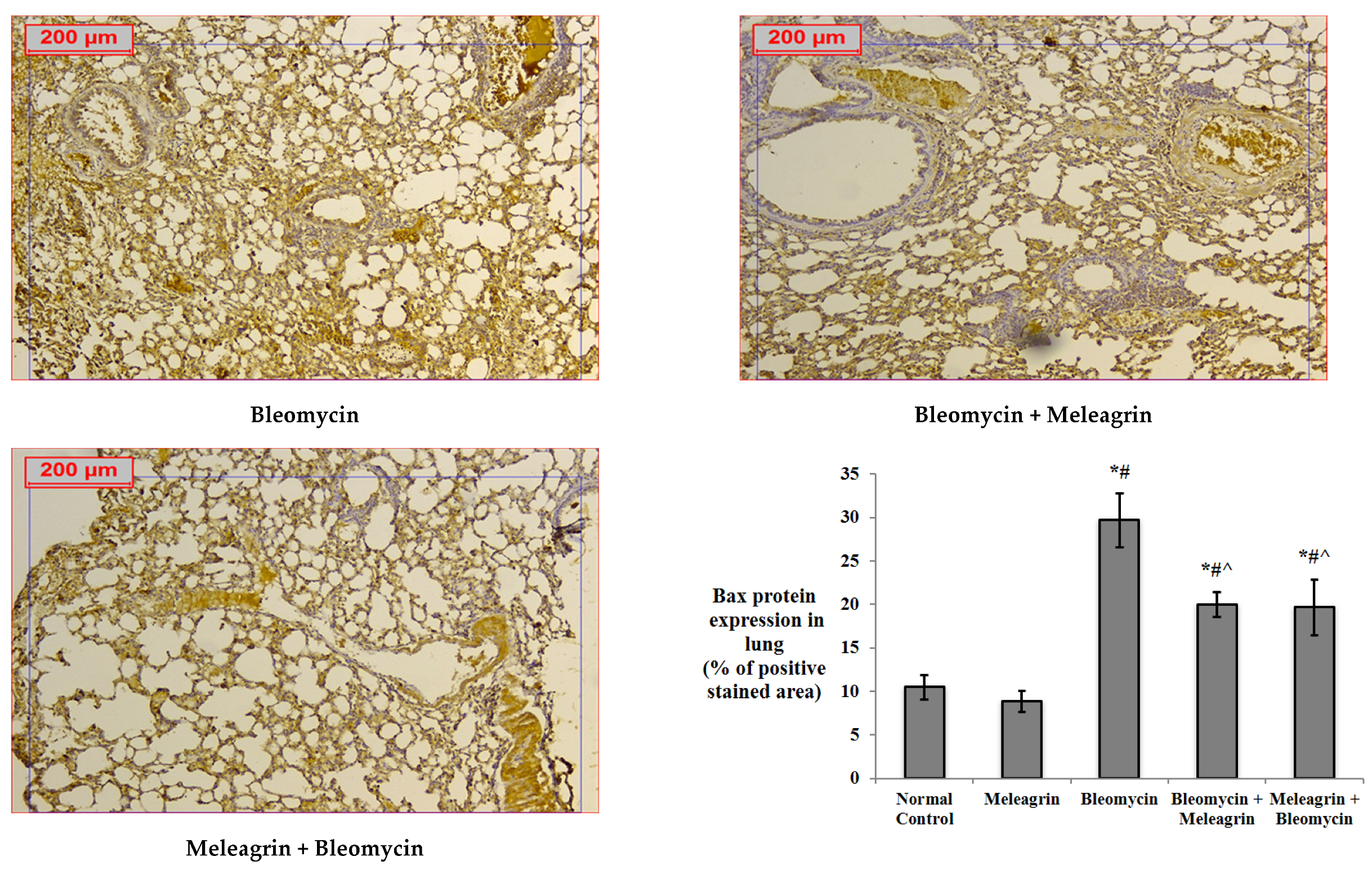 Biomedicines 10 01164 g007b