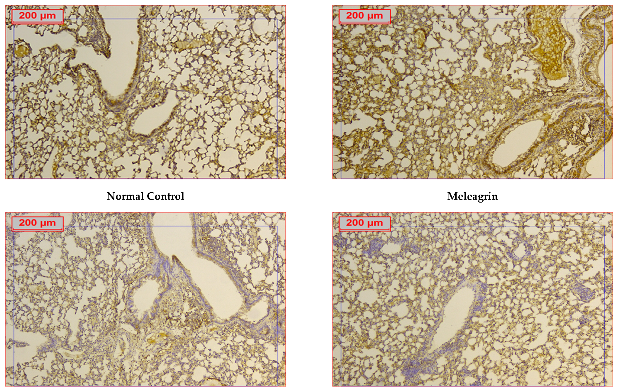 Biomedicines 10 01164 g008a