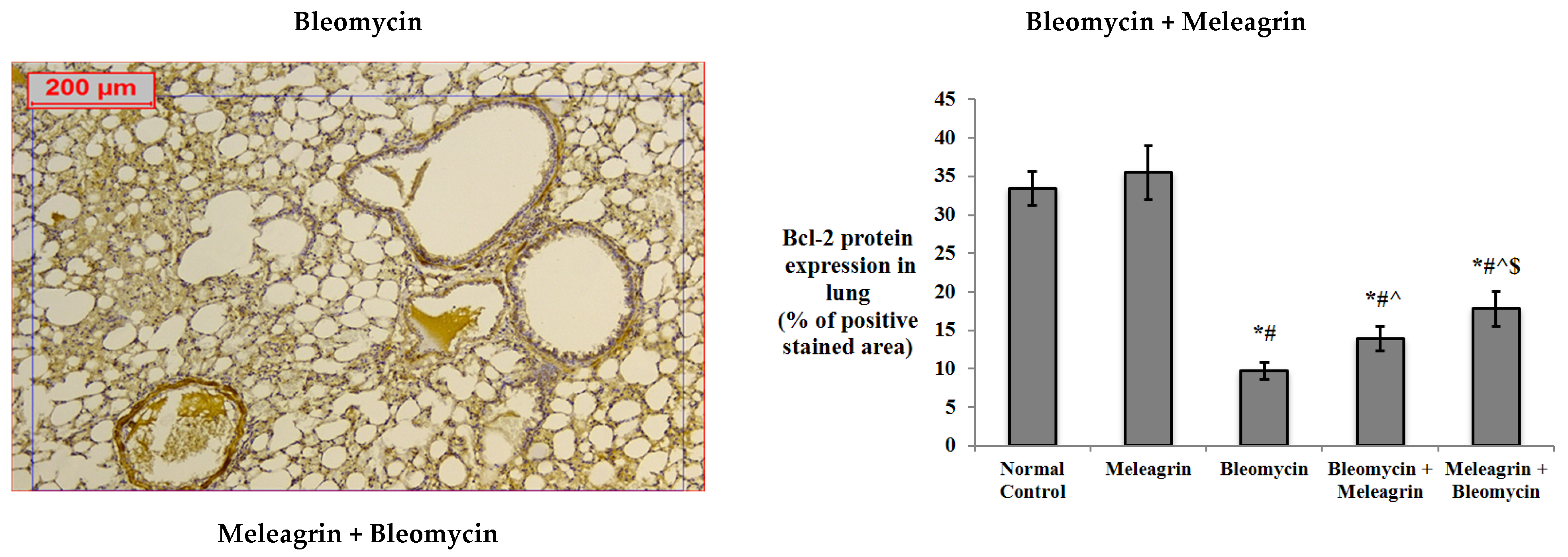 Biomedicines 10 01164 g008b