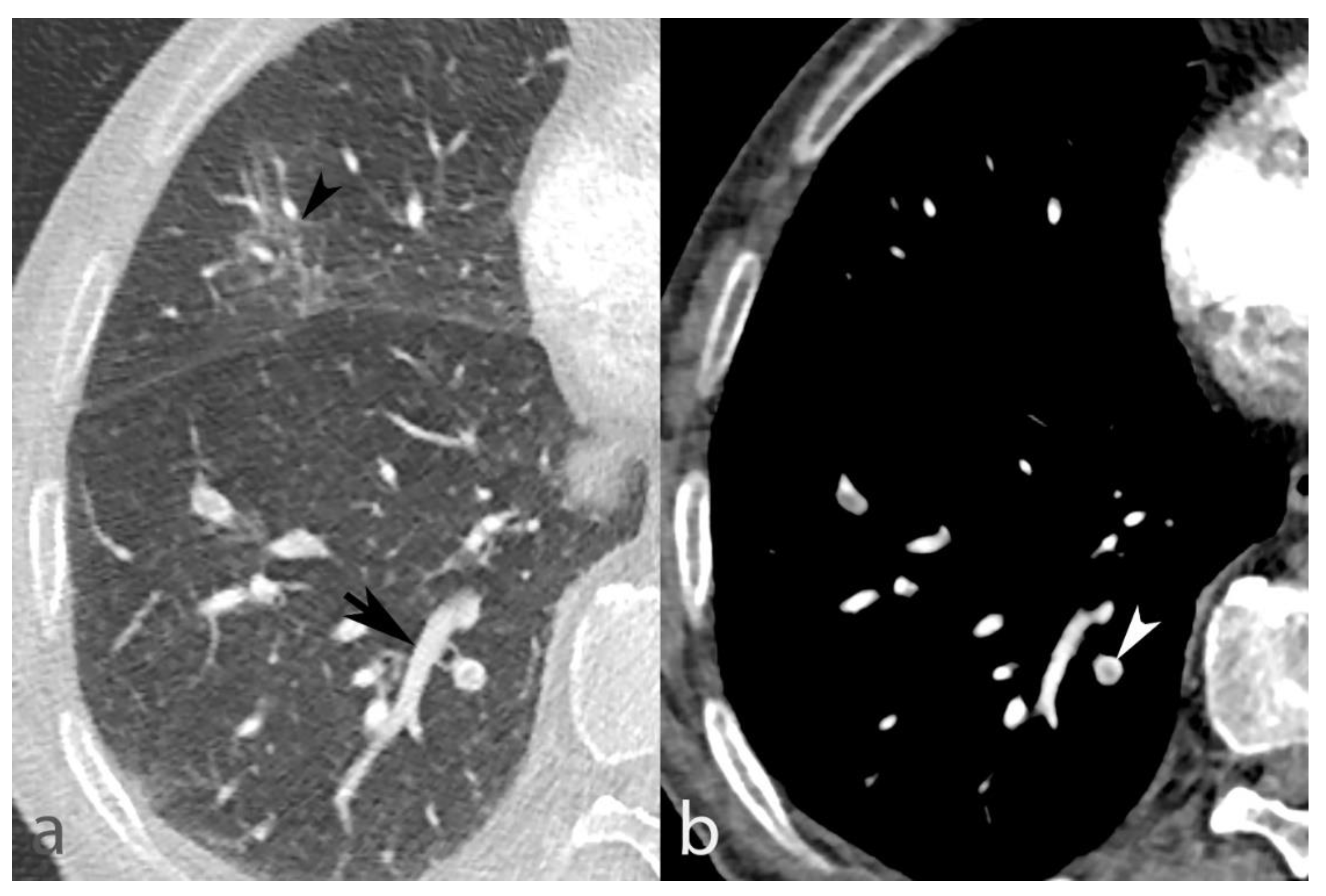Biomedicines 10 01300 g007