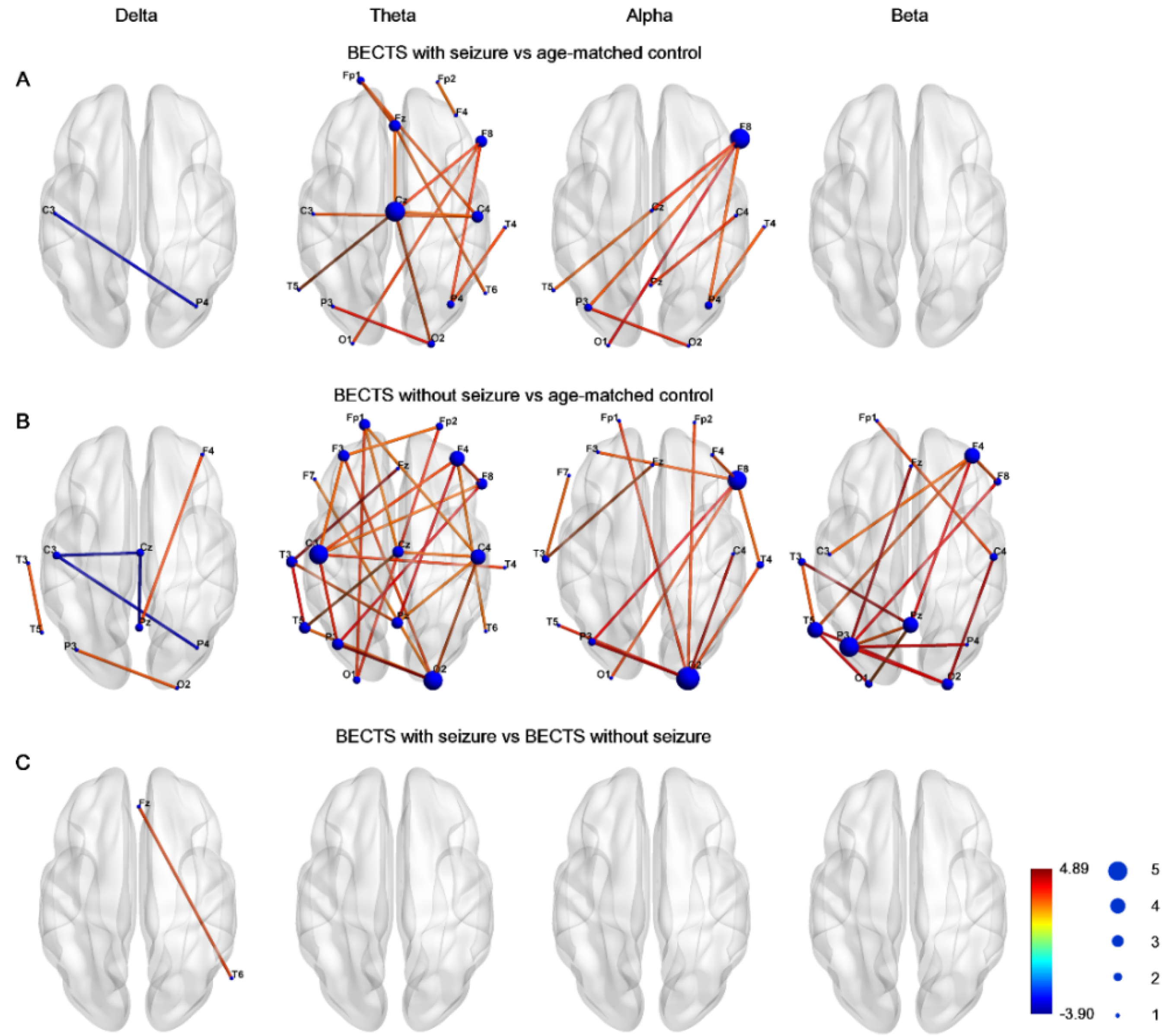 Resting-State EEG Functional Connectivity in Children with
