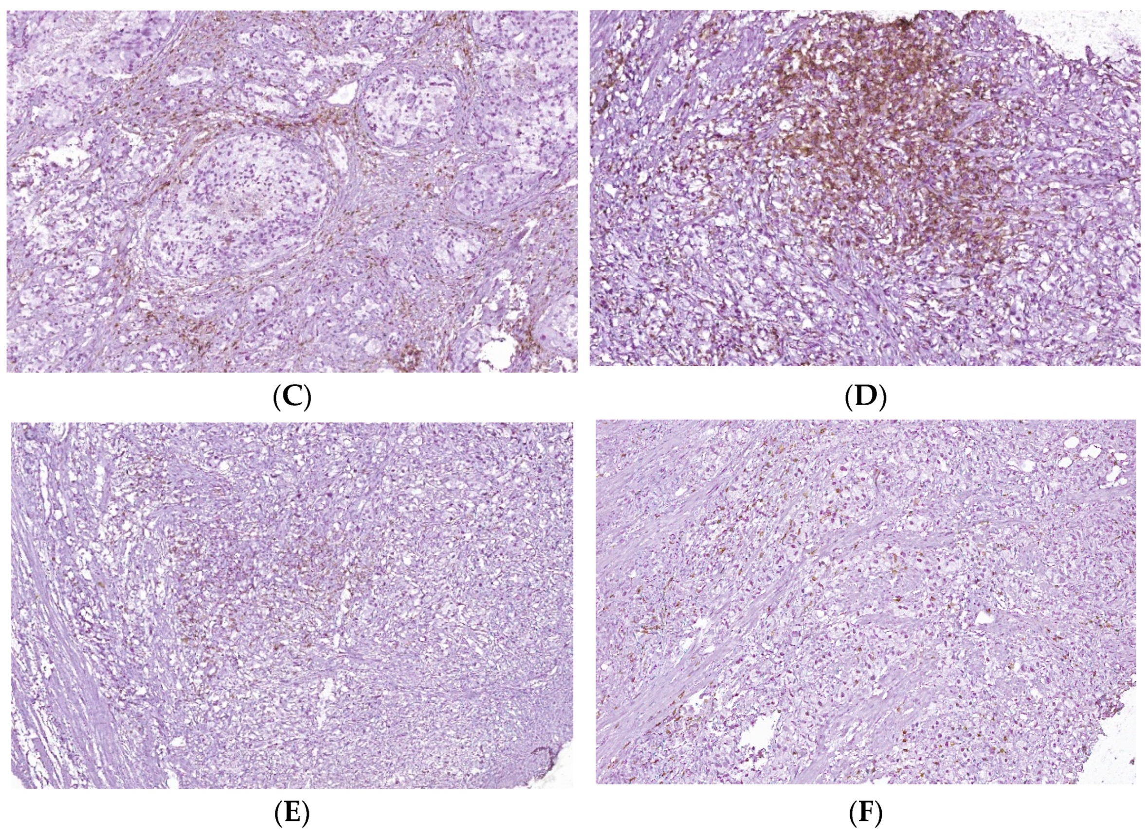 Biomedicines 10 01672 g005b Biomedicines 10 01672 g005b