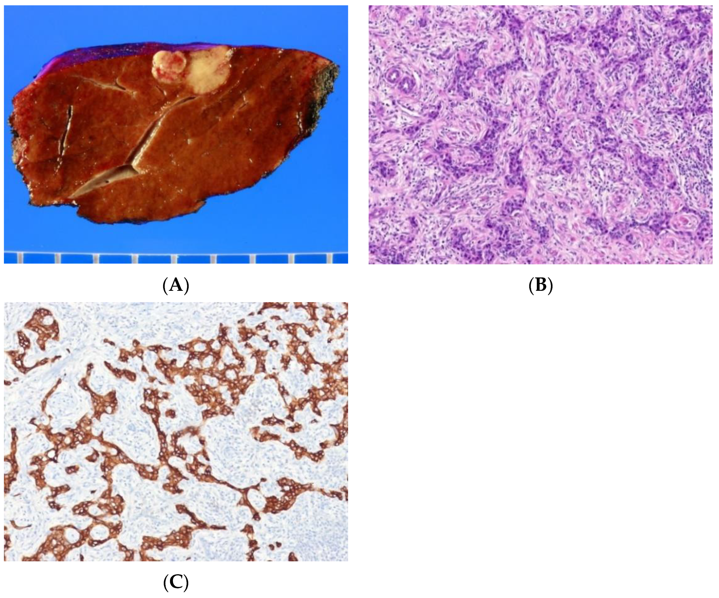 Biomedicines 10 01826 g004