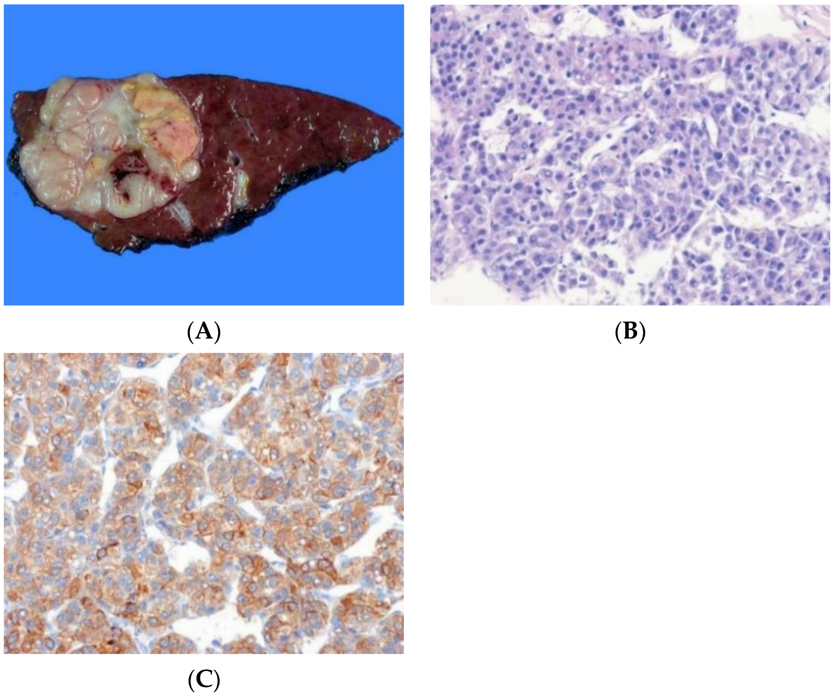 Biomedicines 10 01826 g005