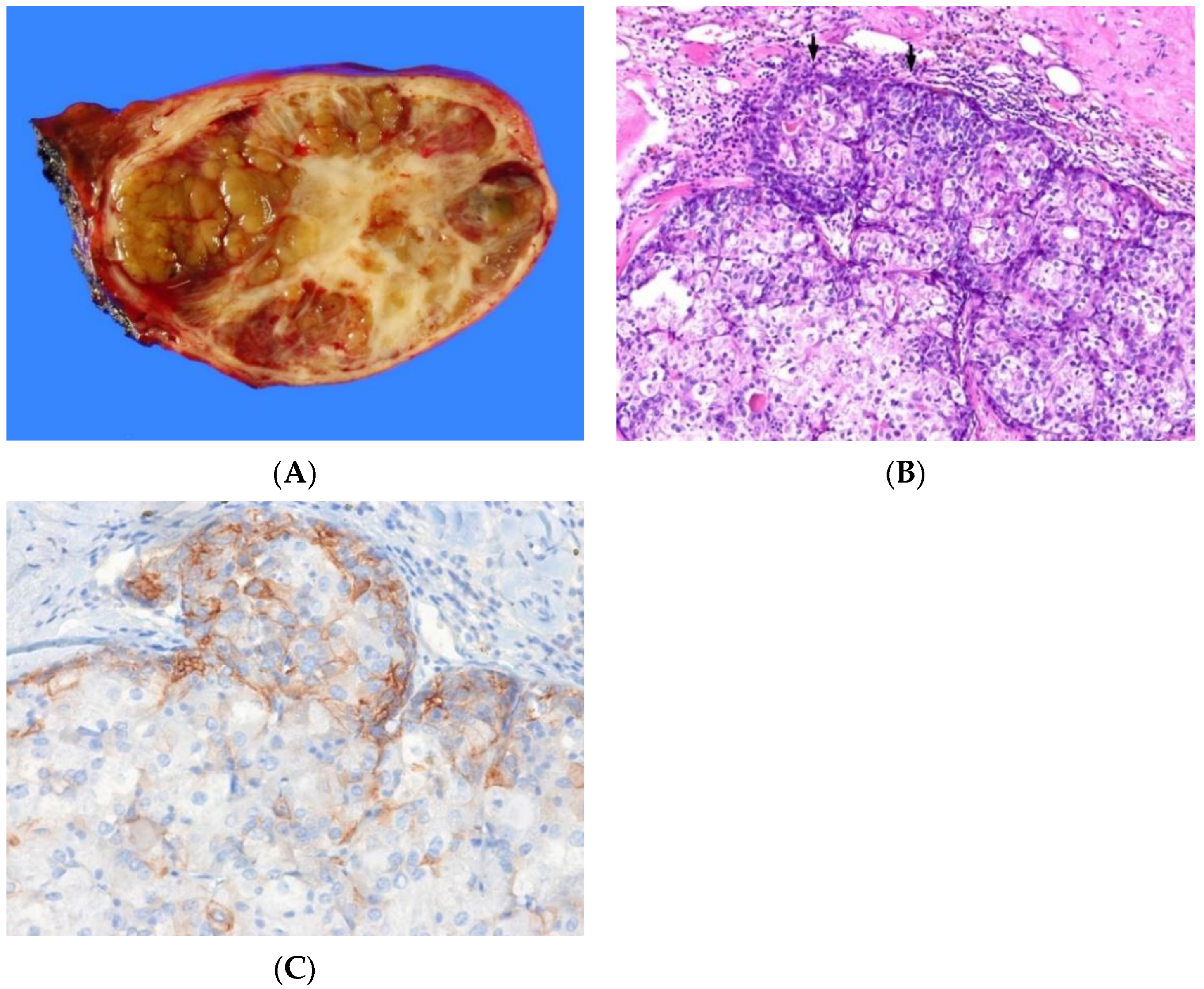 Biomedicines 10 01826 g006