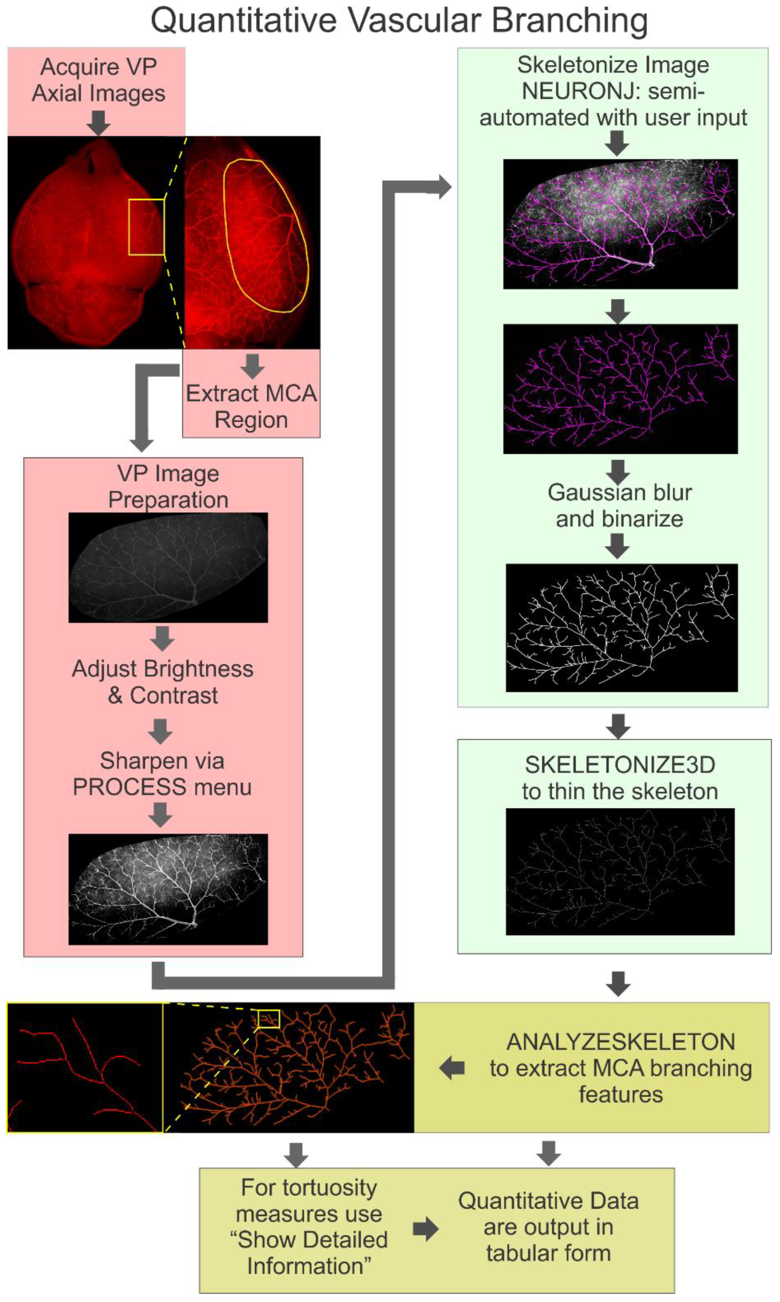 Progressive Vascular Abnormalities in the Aging 3xTg-AD