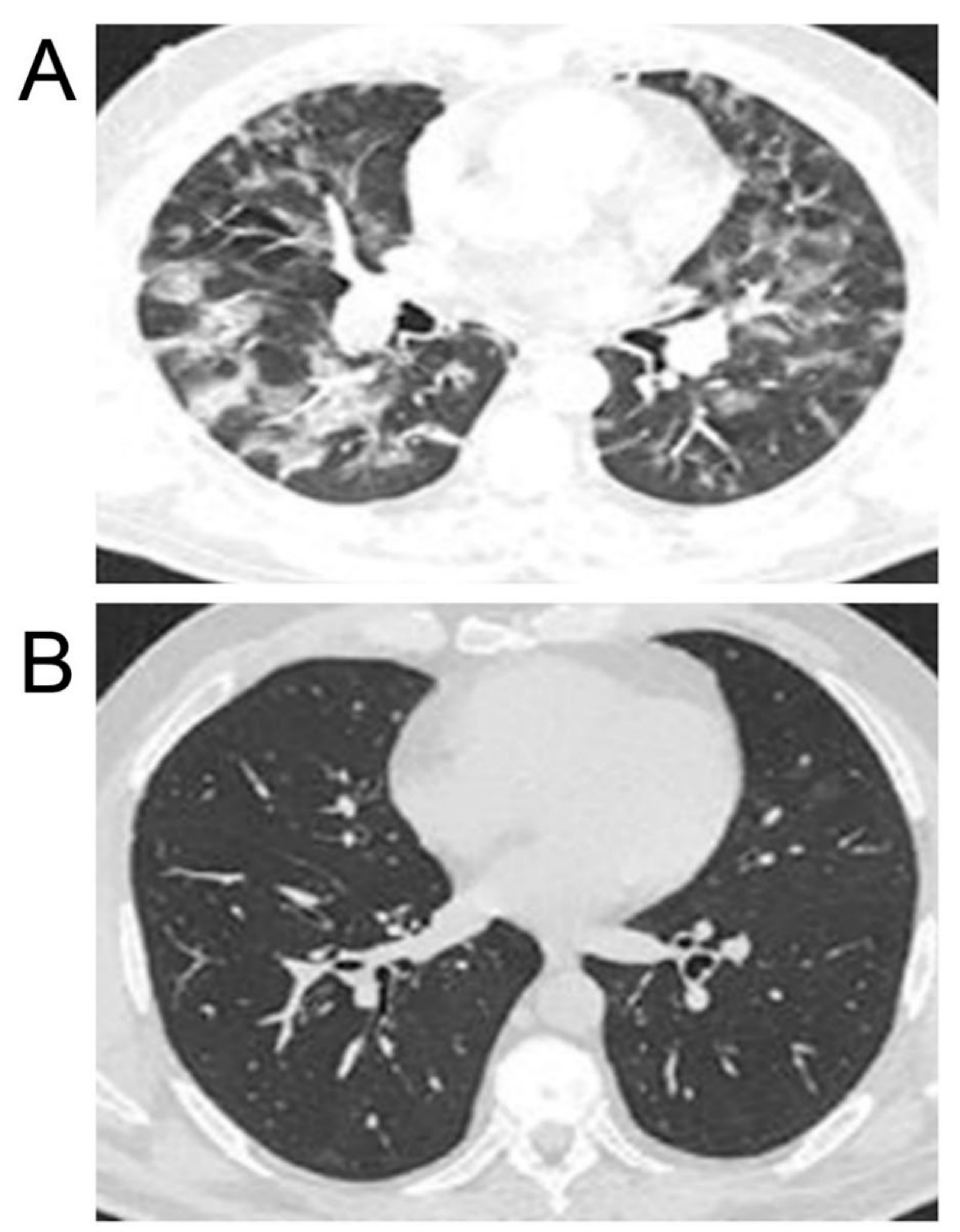 Biomedicines 10 02155 g007 550