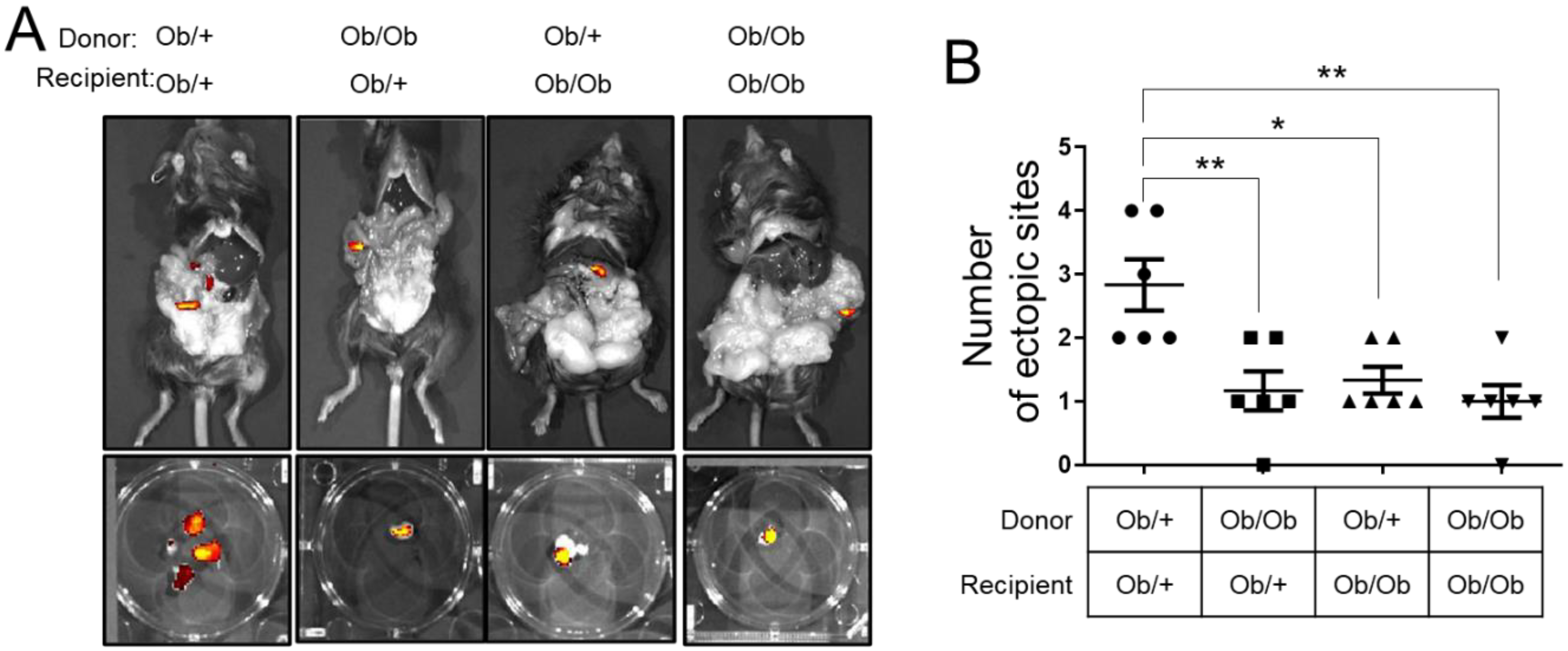 Biomedicines Free FullText Leptin Stimulates Endometriosis Development in Mouse Models