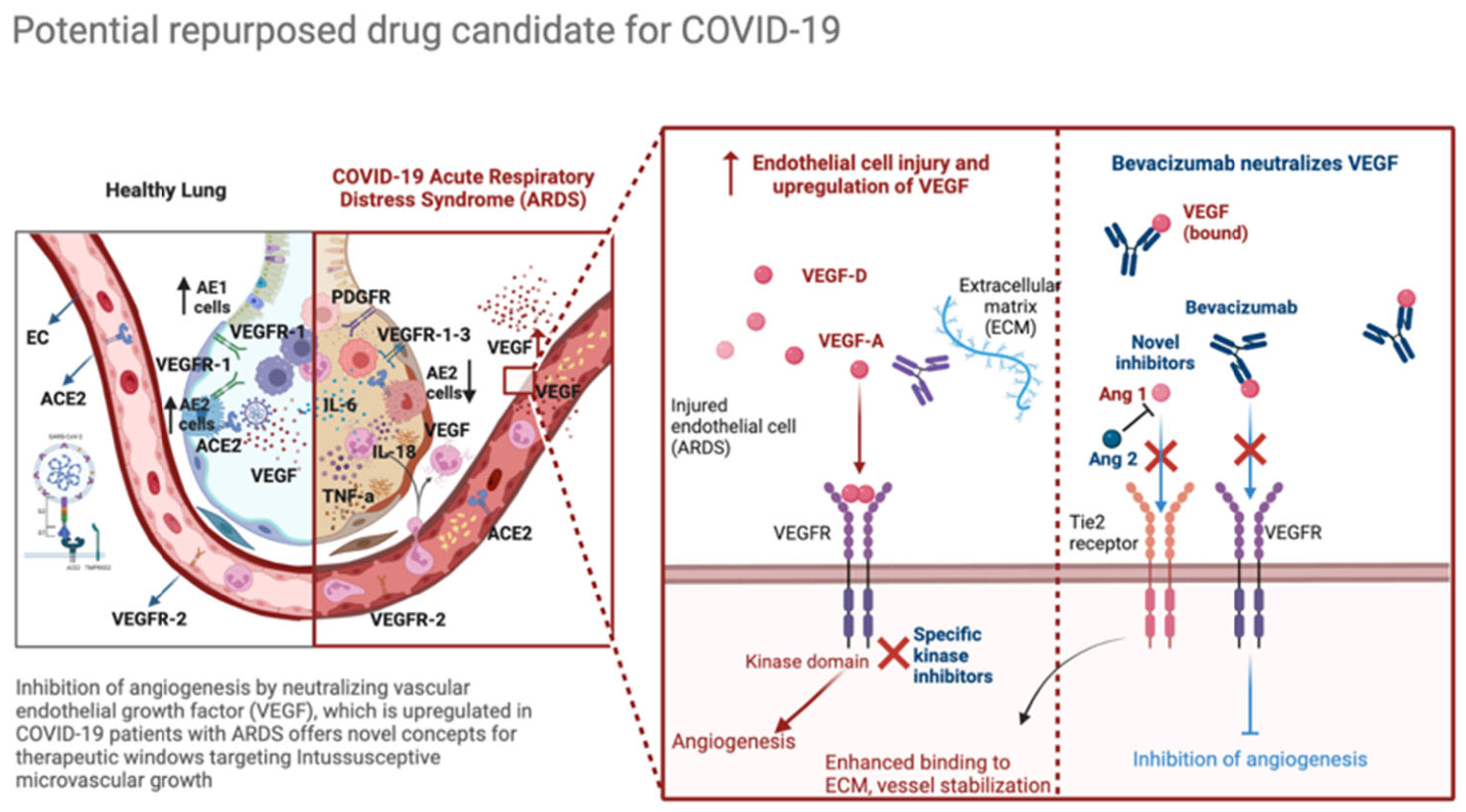 Endothelial cell infection and endotheliitis in COVID-19 - The Lancet