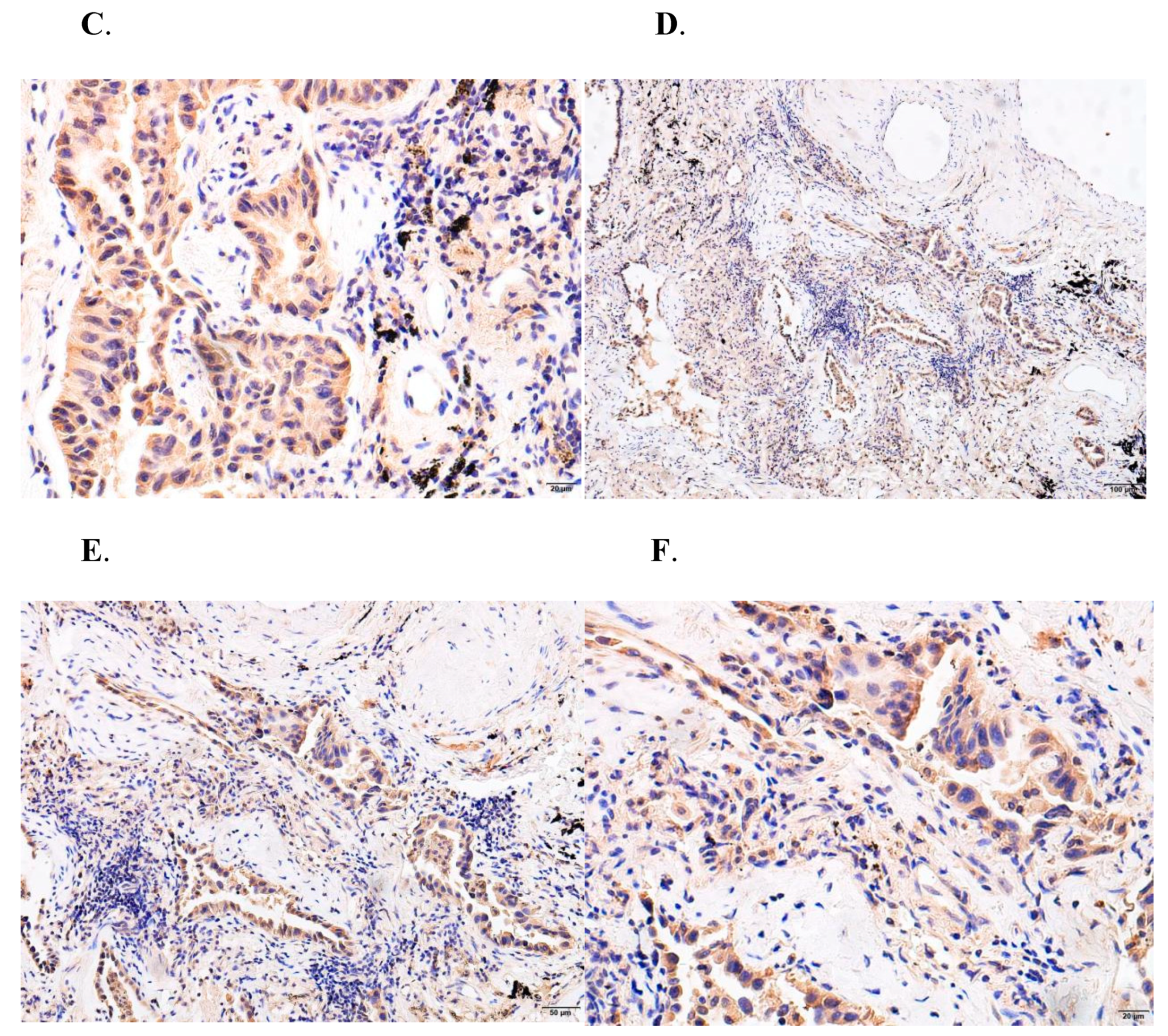 Biomedicines 10 02248 g009b