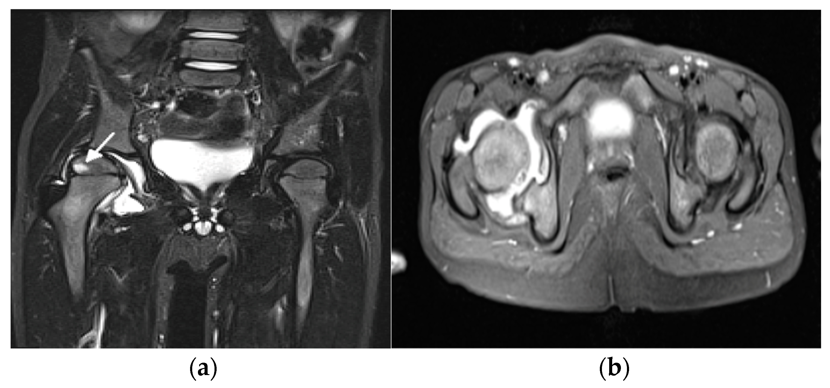 Biomedicines 10 02417 g004 Biomedicines 10 02417 g004