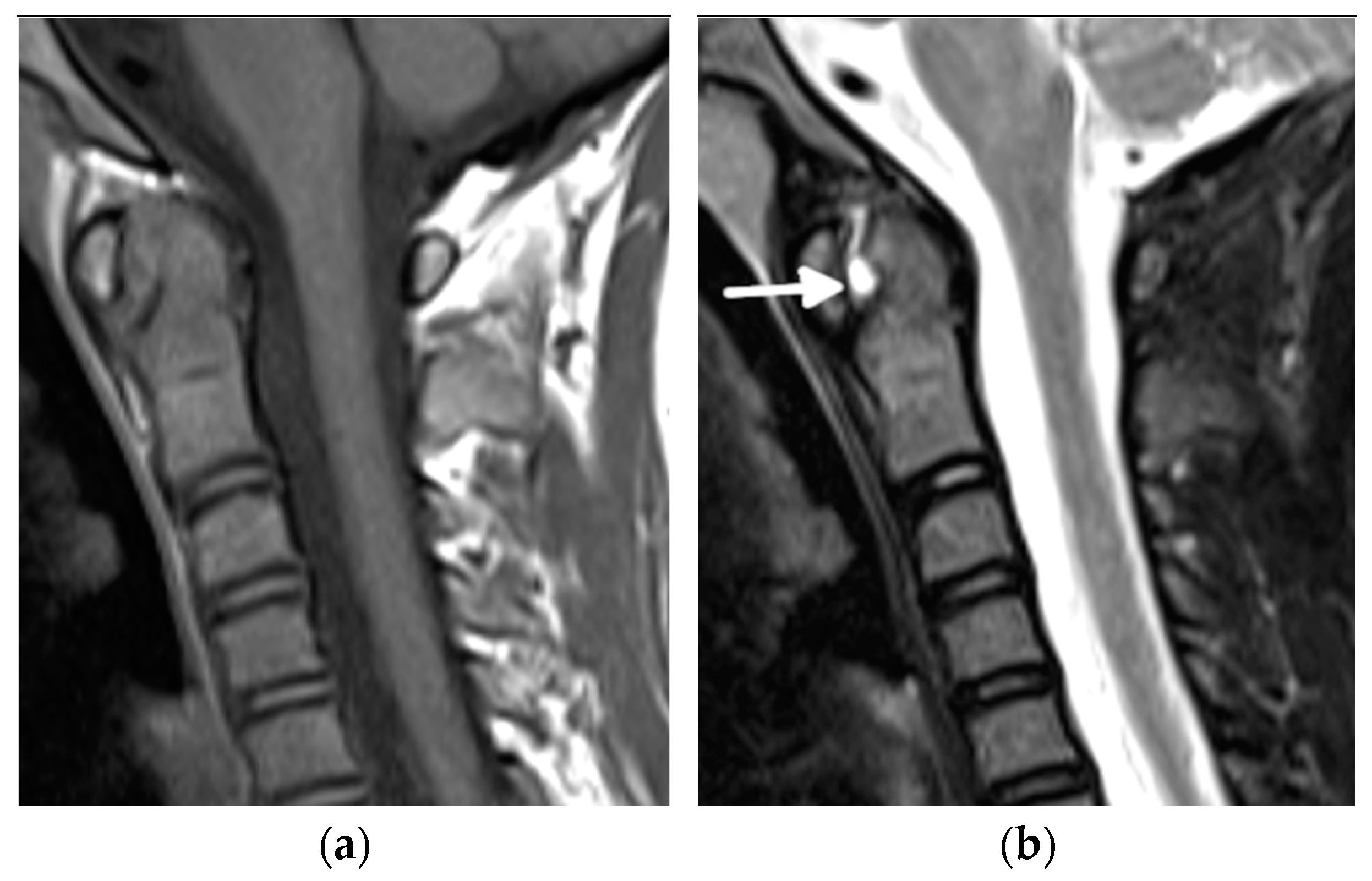 Biomedicines 10 02417 g006a Biomedicines 10 02417 g006a
