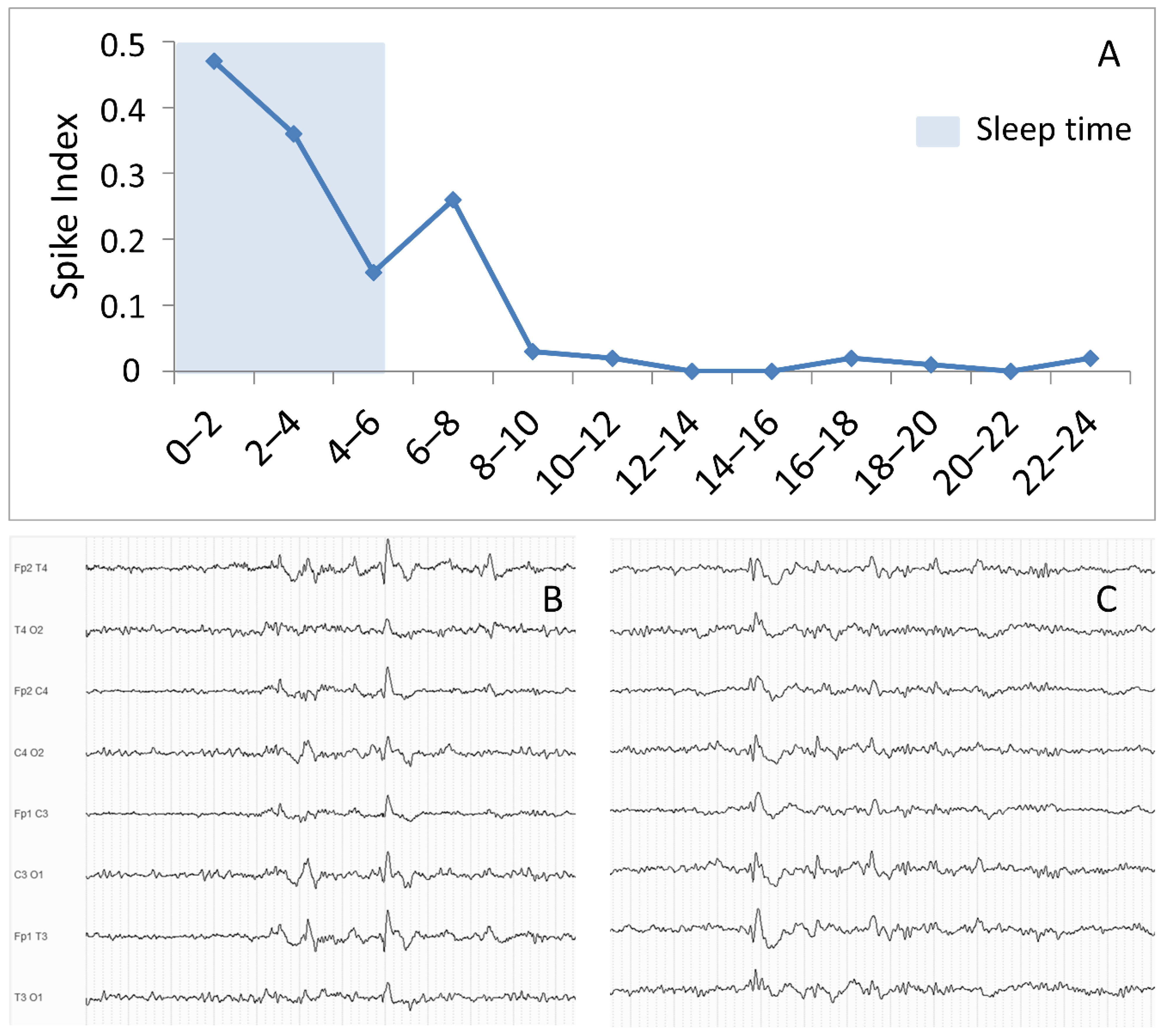 Biomedicines Free FullText EEG Markers of Treatment Resistance in