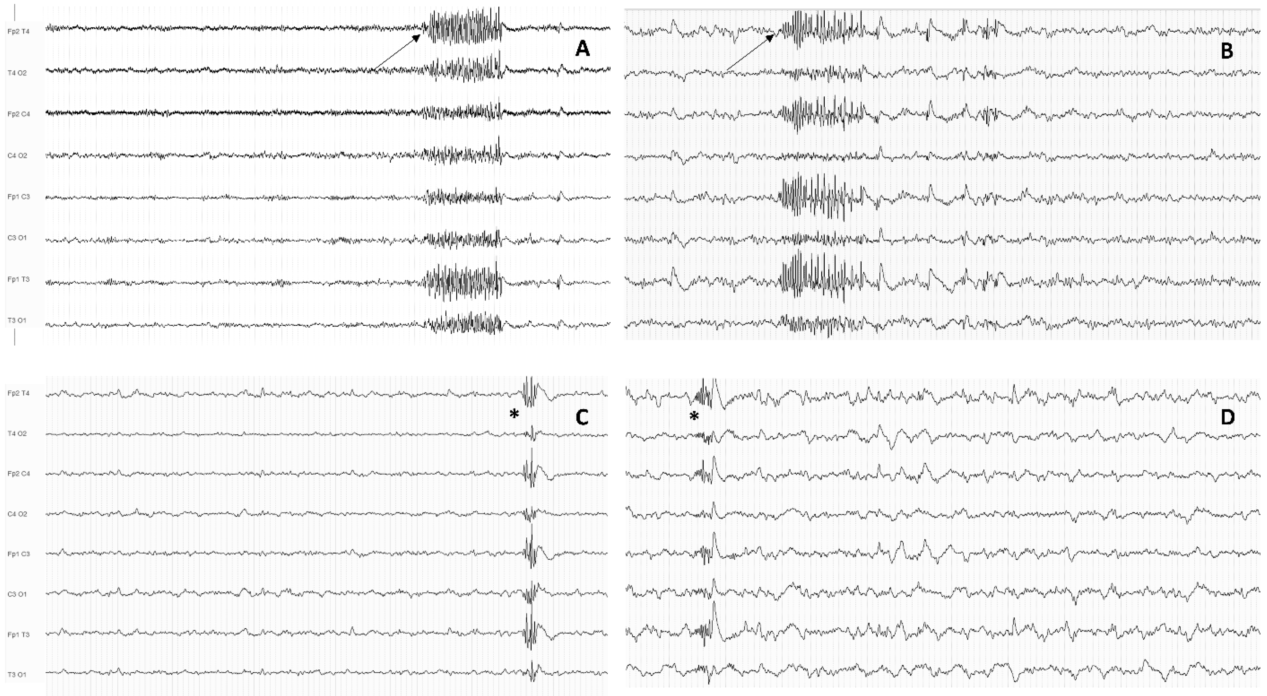 A 30 Year Old Male Experienced A Generalized Seizure