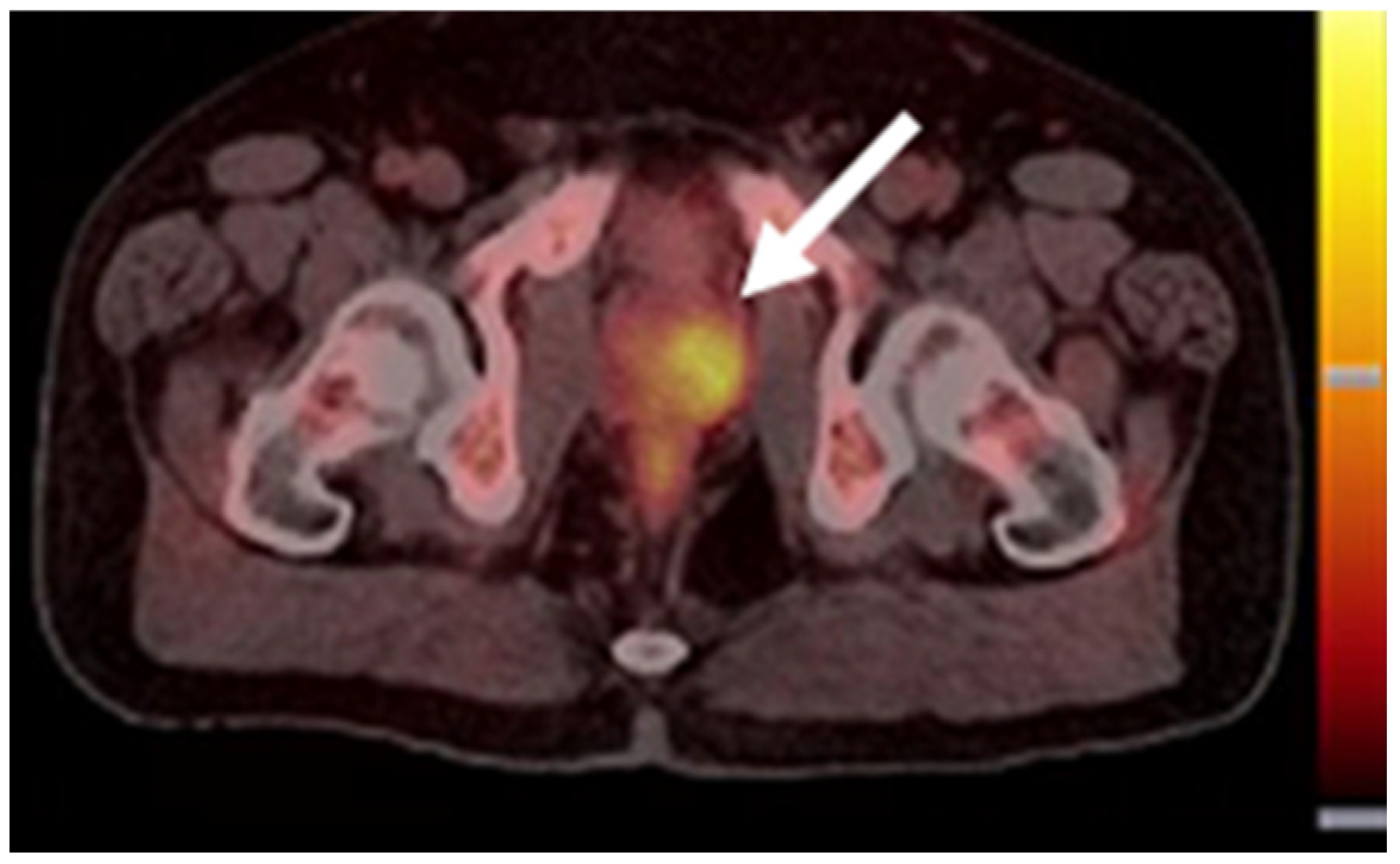 Biomedicines 10 02533 g003 Biomedicines 10 02533 g003
