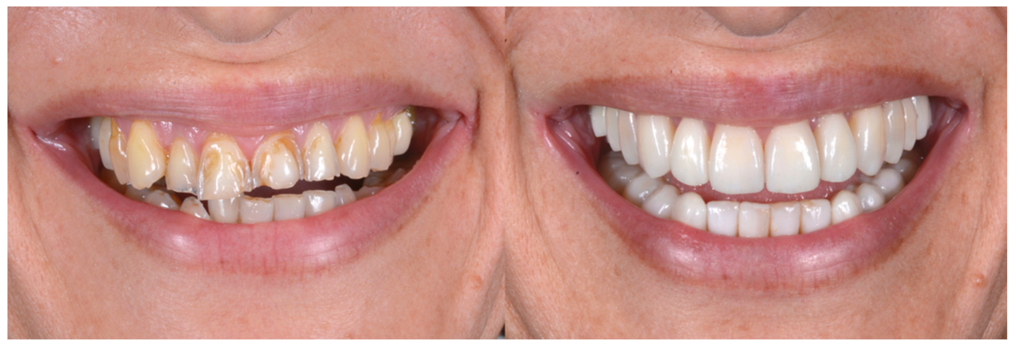 Biomedicines 10 02536 g011 Biomedicines 10 02536 g011