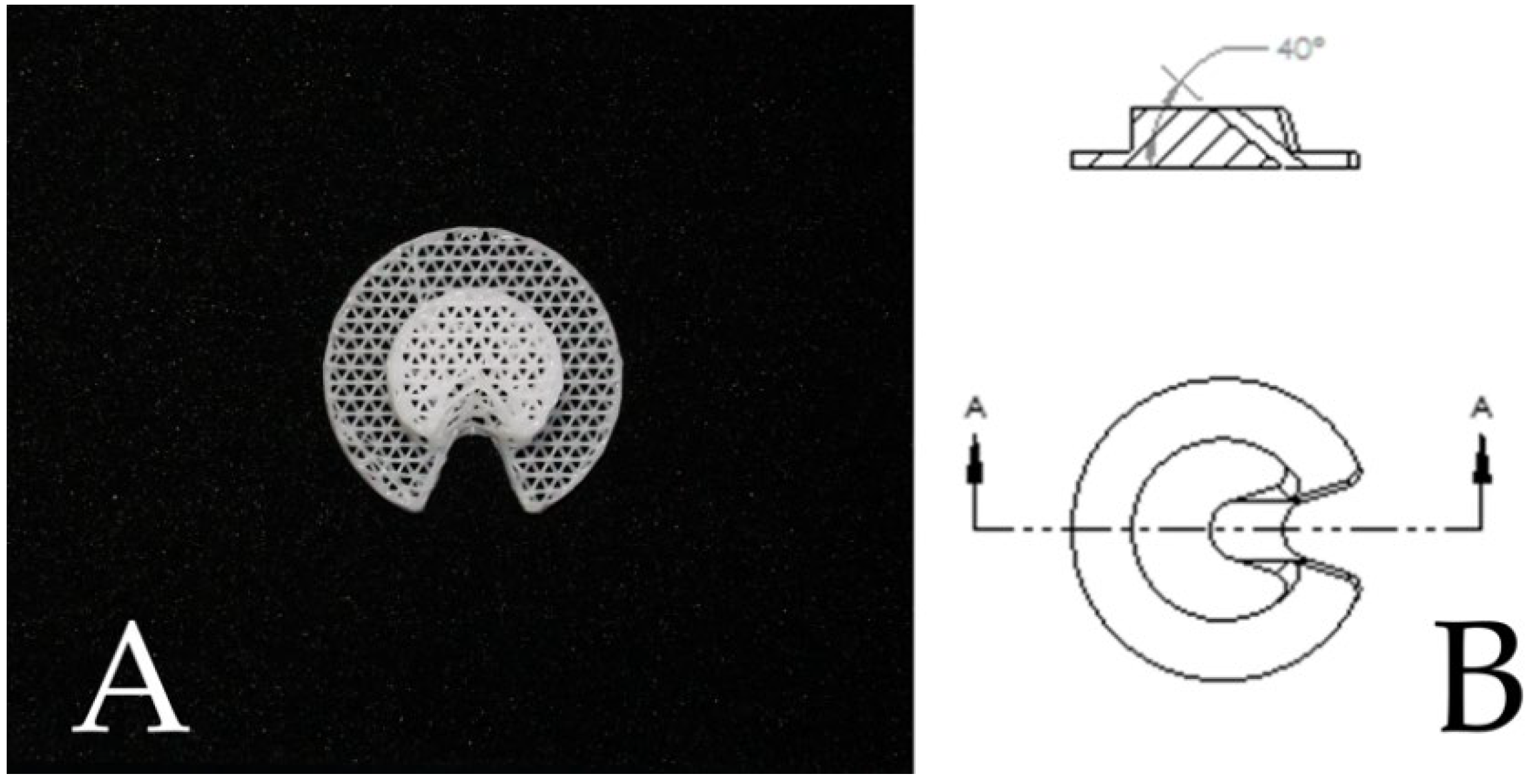 Biomedicines | Free Full-Text | Clinical Outcomes of 3D-Printed 