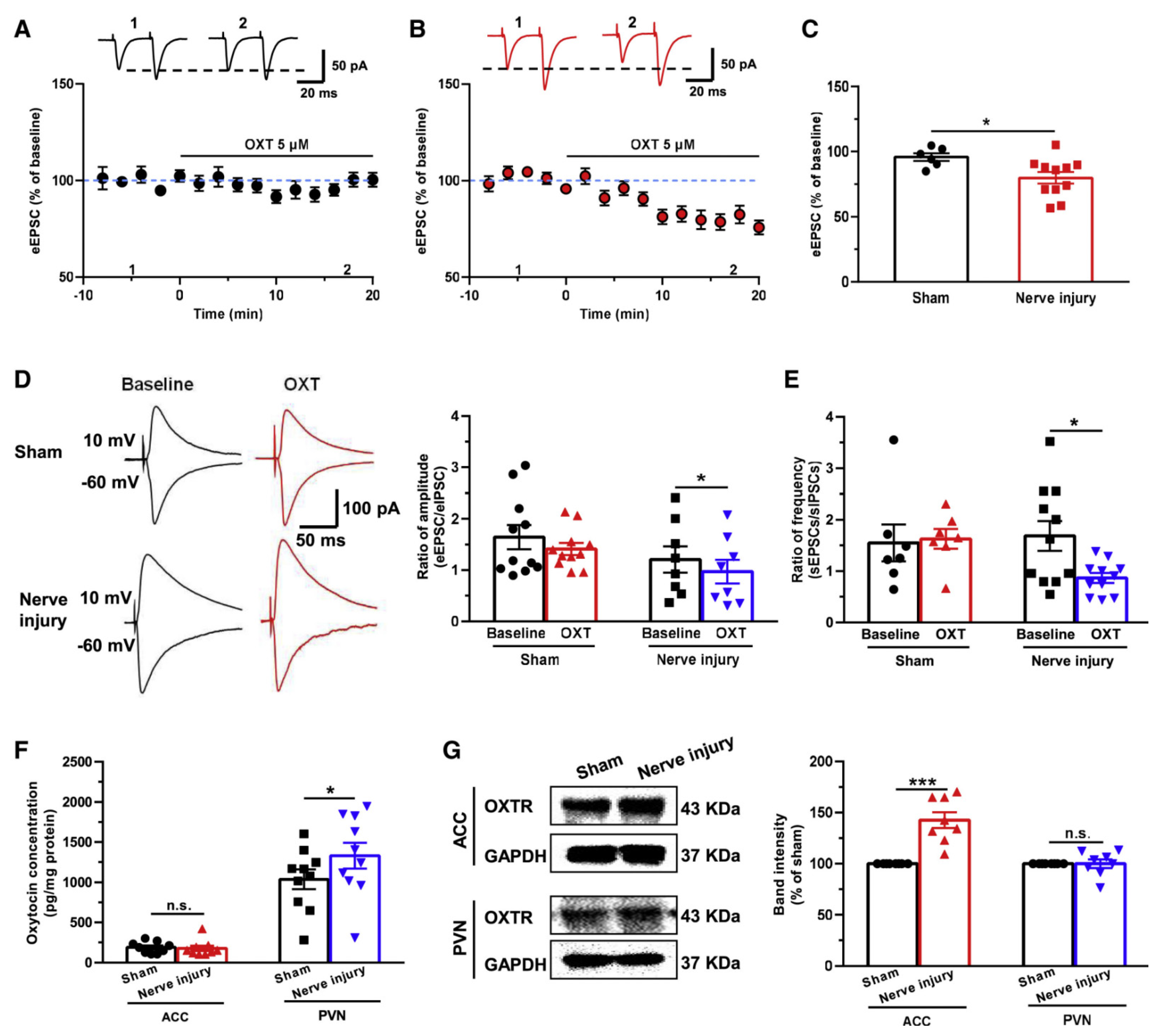 ブレイン Synaptic Plasticity in the Pain-Related Cingulate and