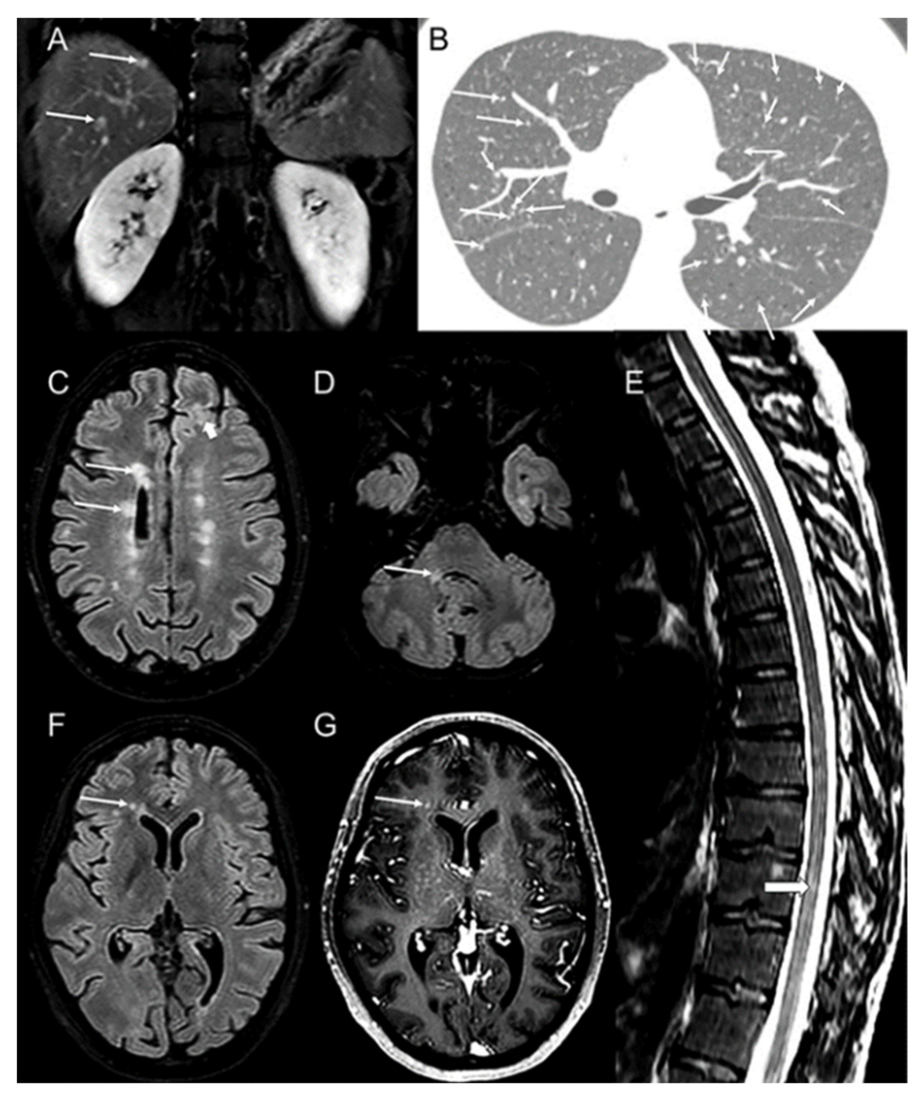 Biomedicines 10 02850 g001 Biomedicines 10 02850 g001