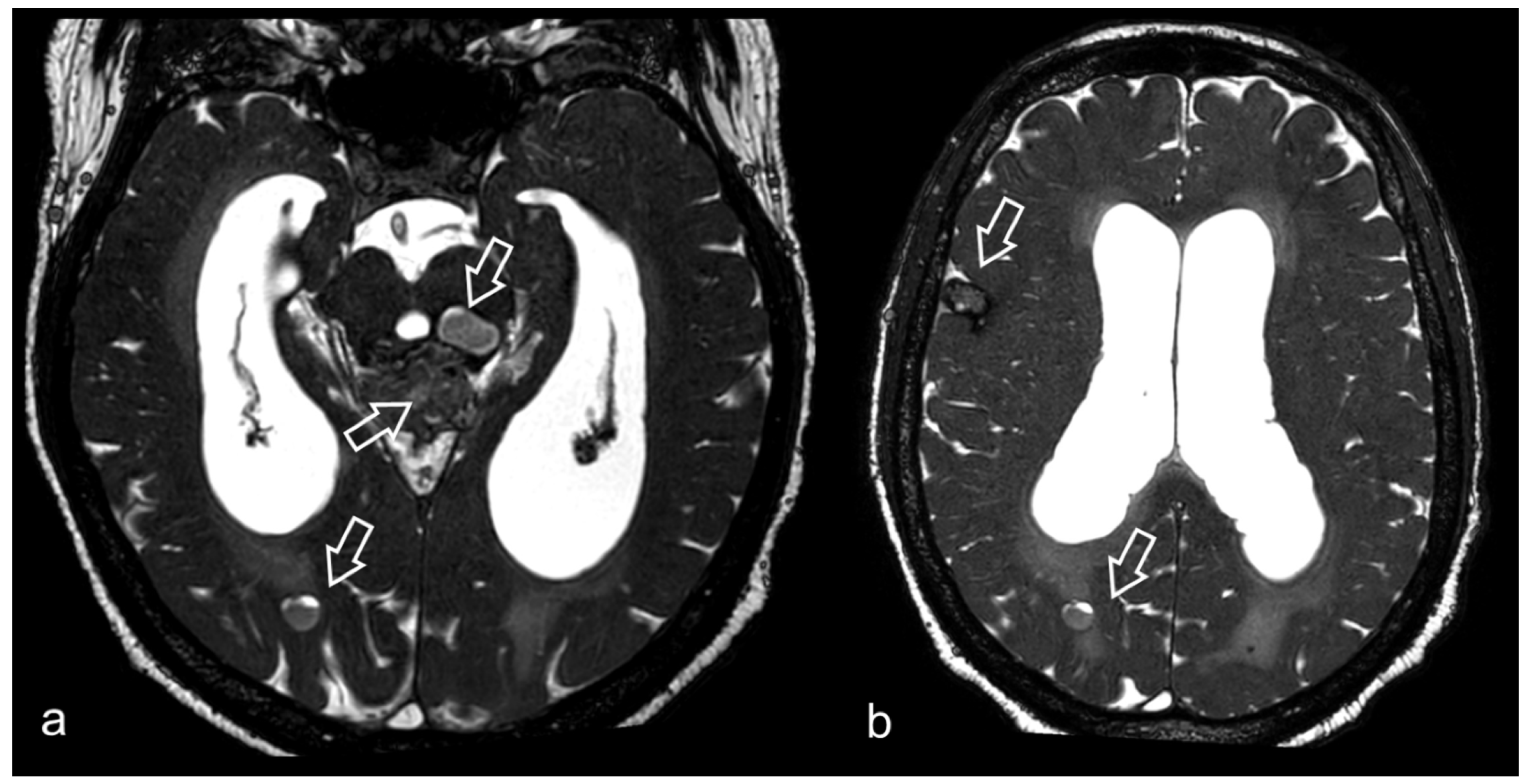 Biomedicines 10 02997 g005 Biomedicines 10 02997 g005