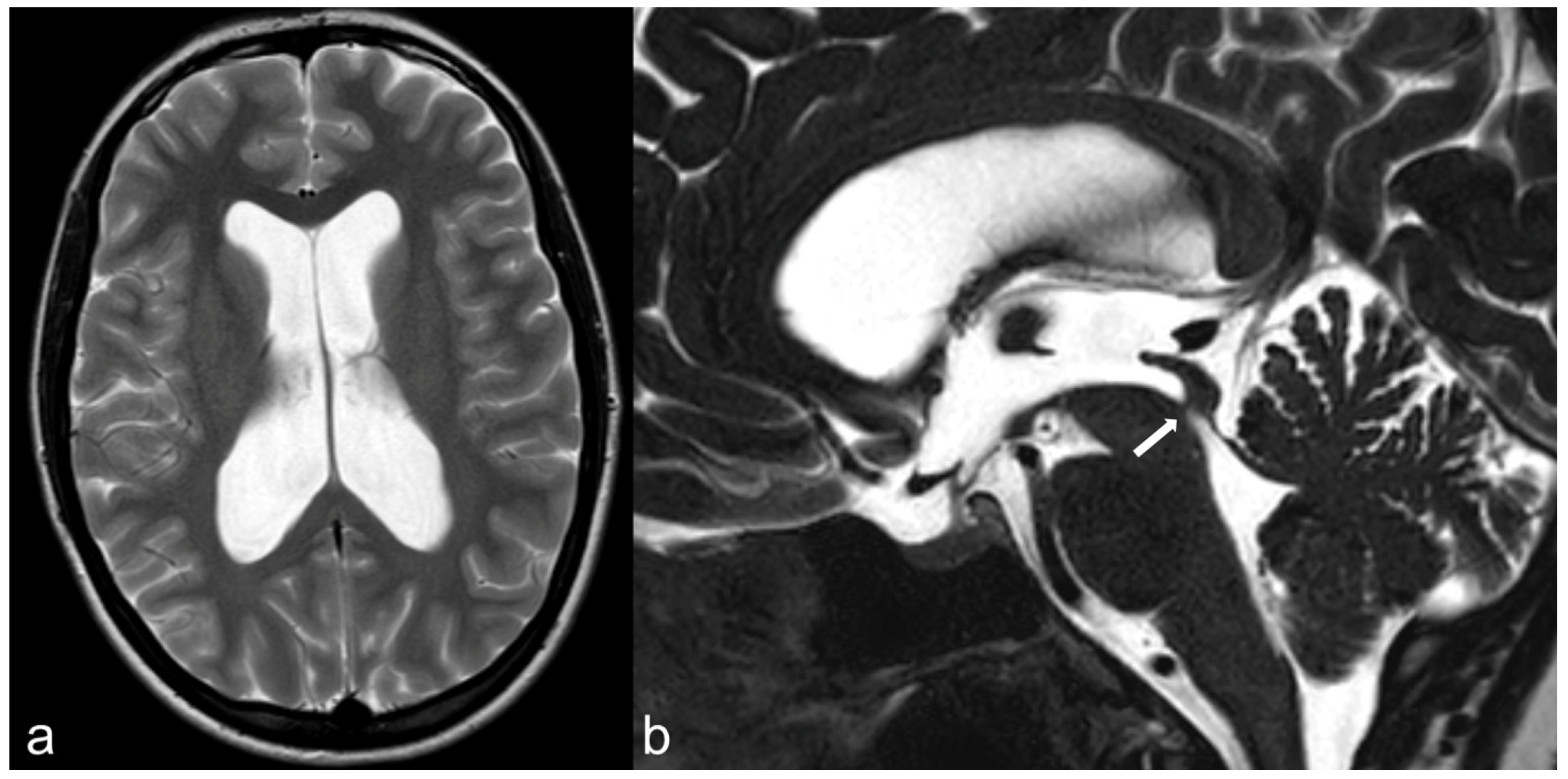 Biomedicines 10 02997 g007 Biomedicines 10 02997 g007