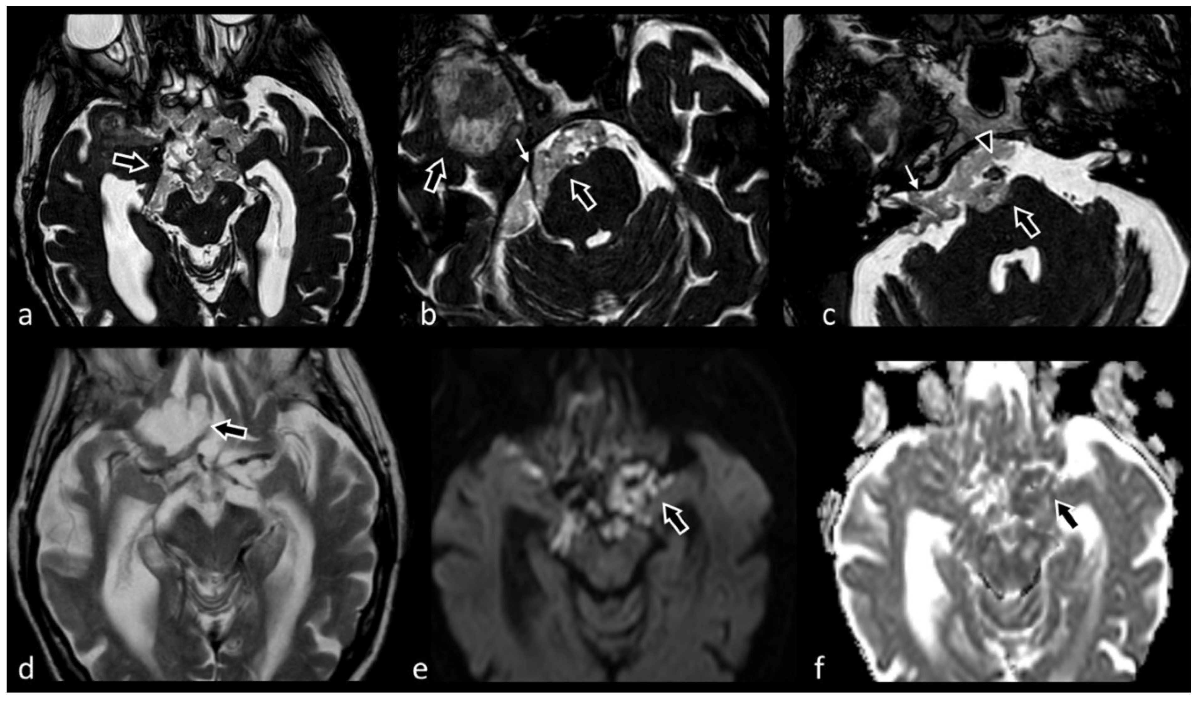 Biomedicines 10 02997 g011 Biomedicines 10 02997 g011