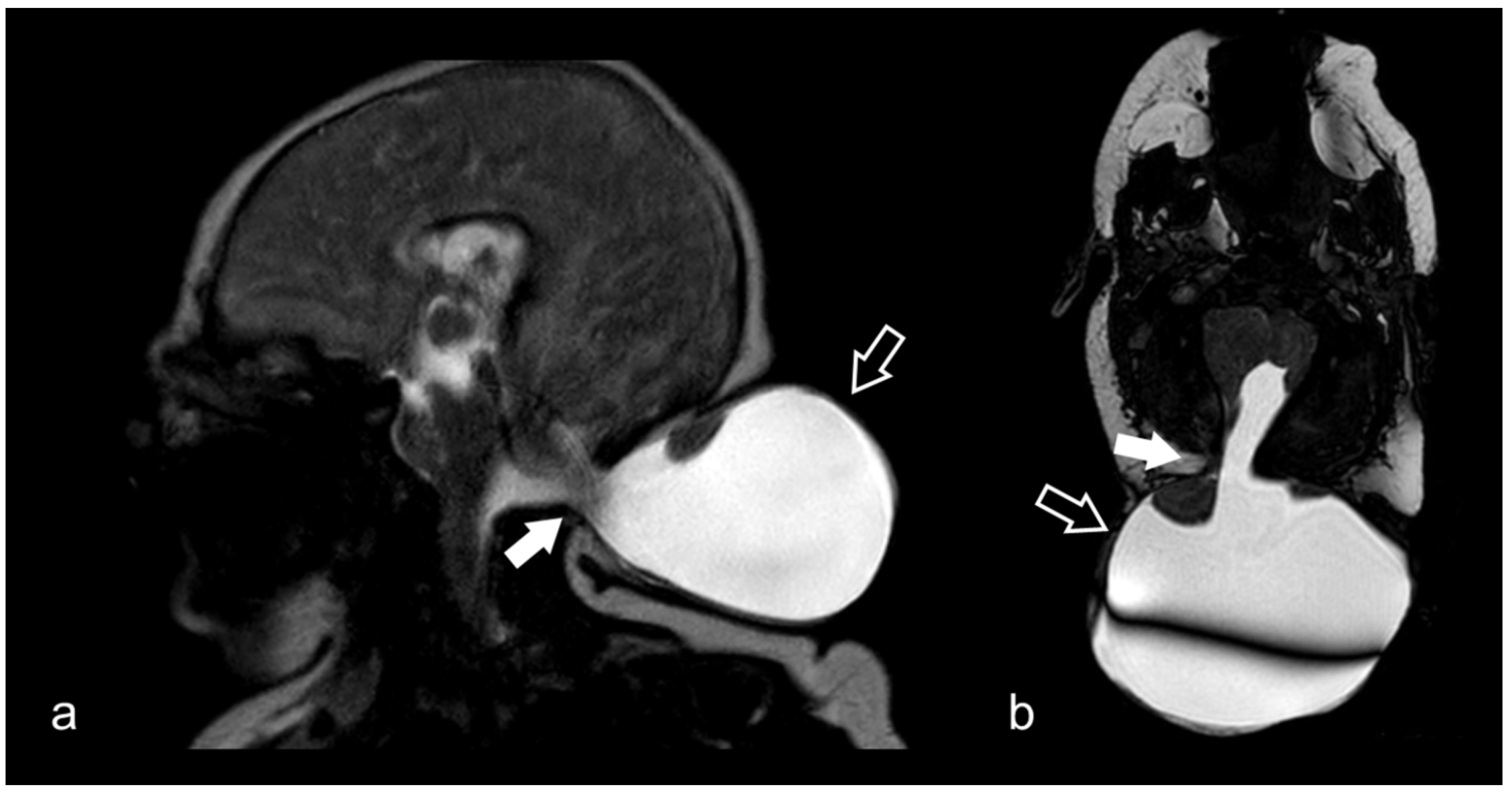 Biomedicines 10 02997 g012 Biomedicines 10 02997 g012