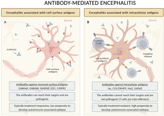 Biomedicines | Free Full-Text | Seizures, Epilepsy, and NORSE Secondary ...