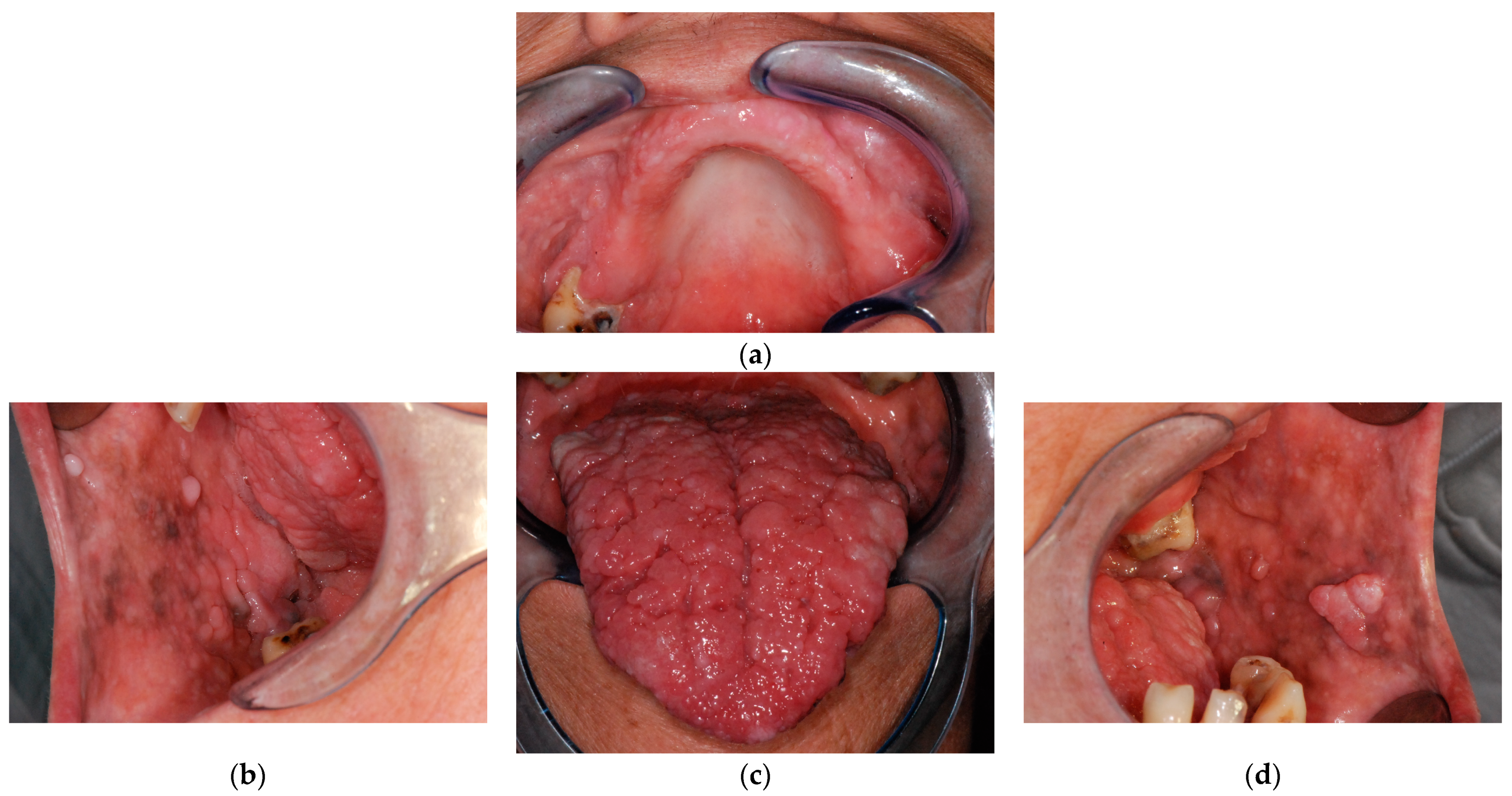 Biomedicines 11 00081 g002a Biomedicines 11 00081 g002a