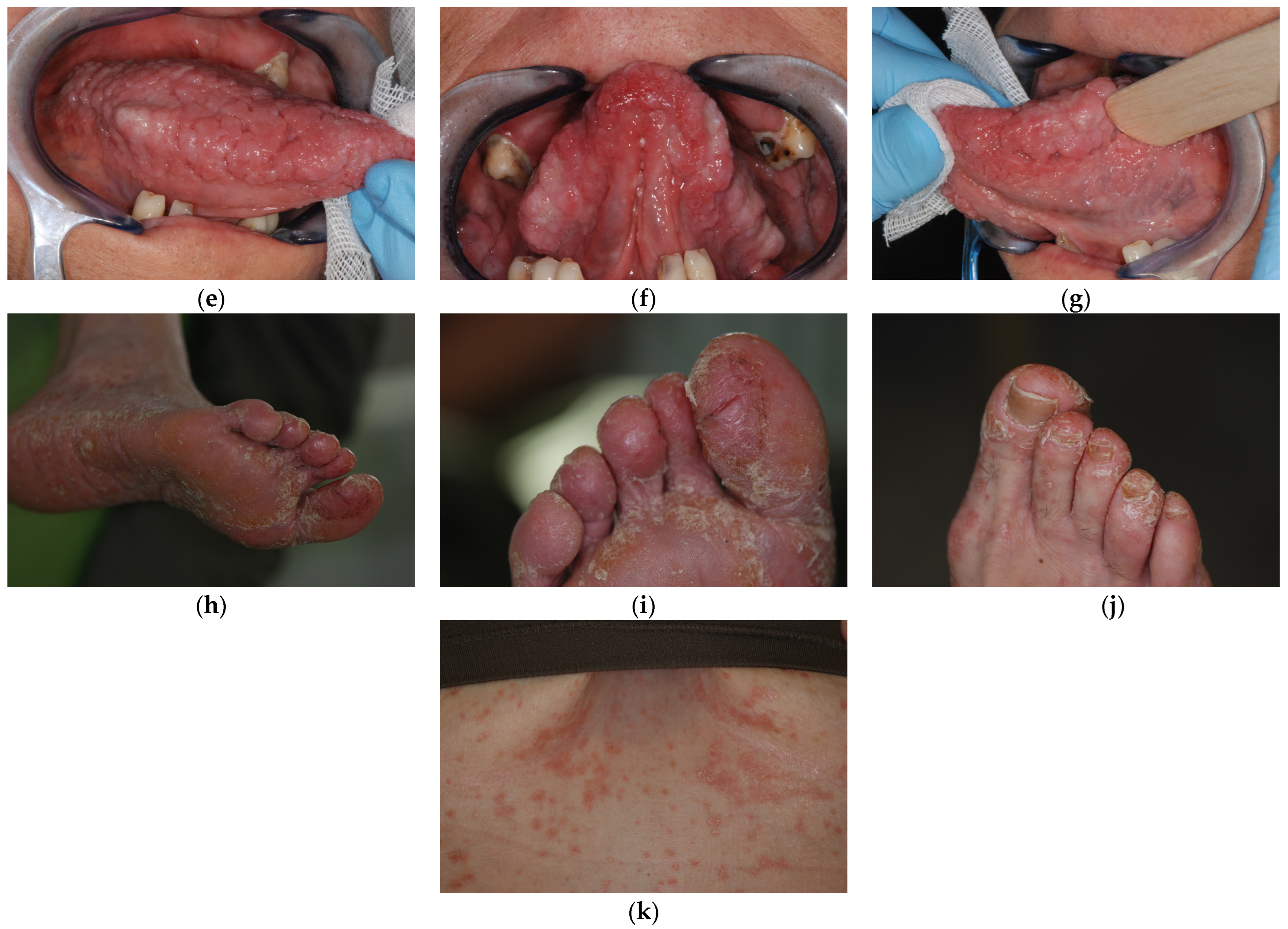 Biomedicines 11 00081 g002b Biomedicines 11 00081 g002b