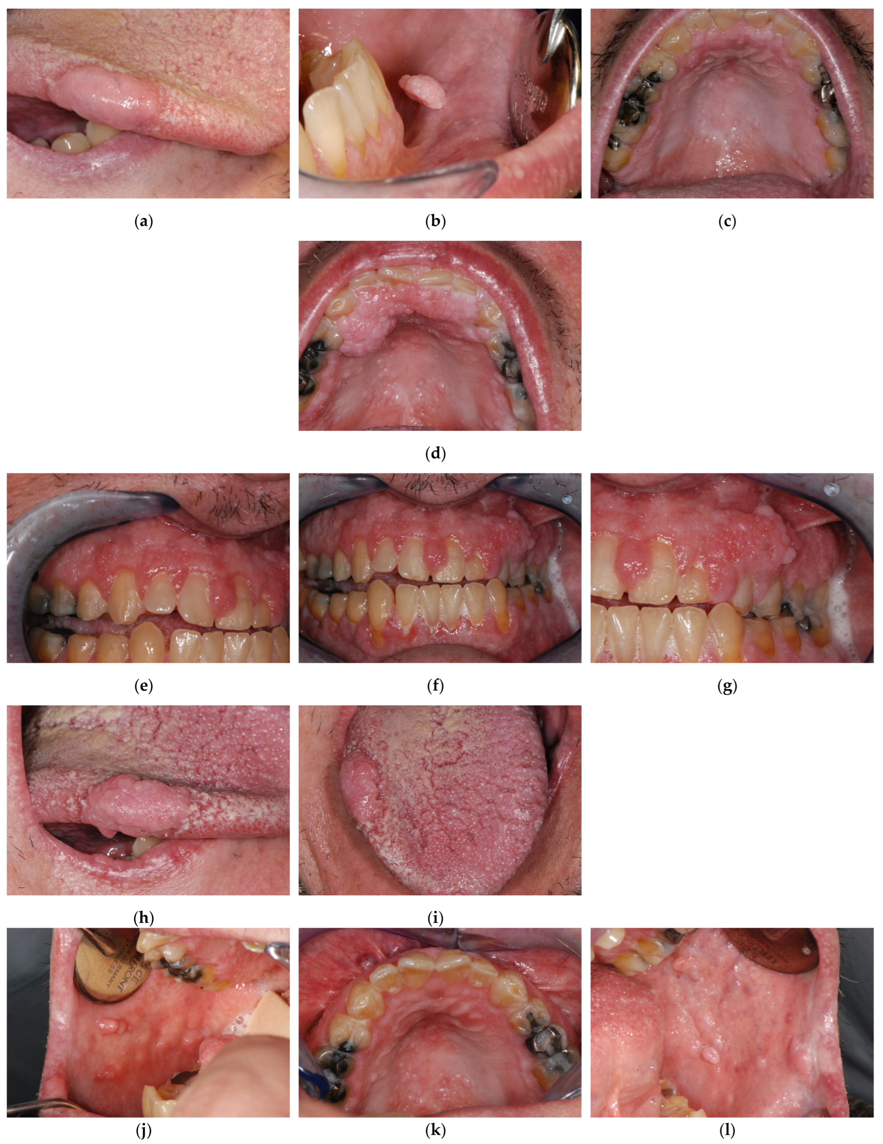Biomedicines 11 00081 g005a Biomedicines 11 00081 g005a