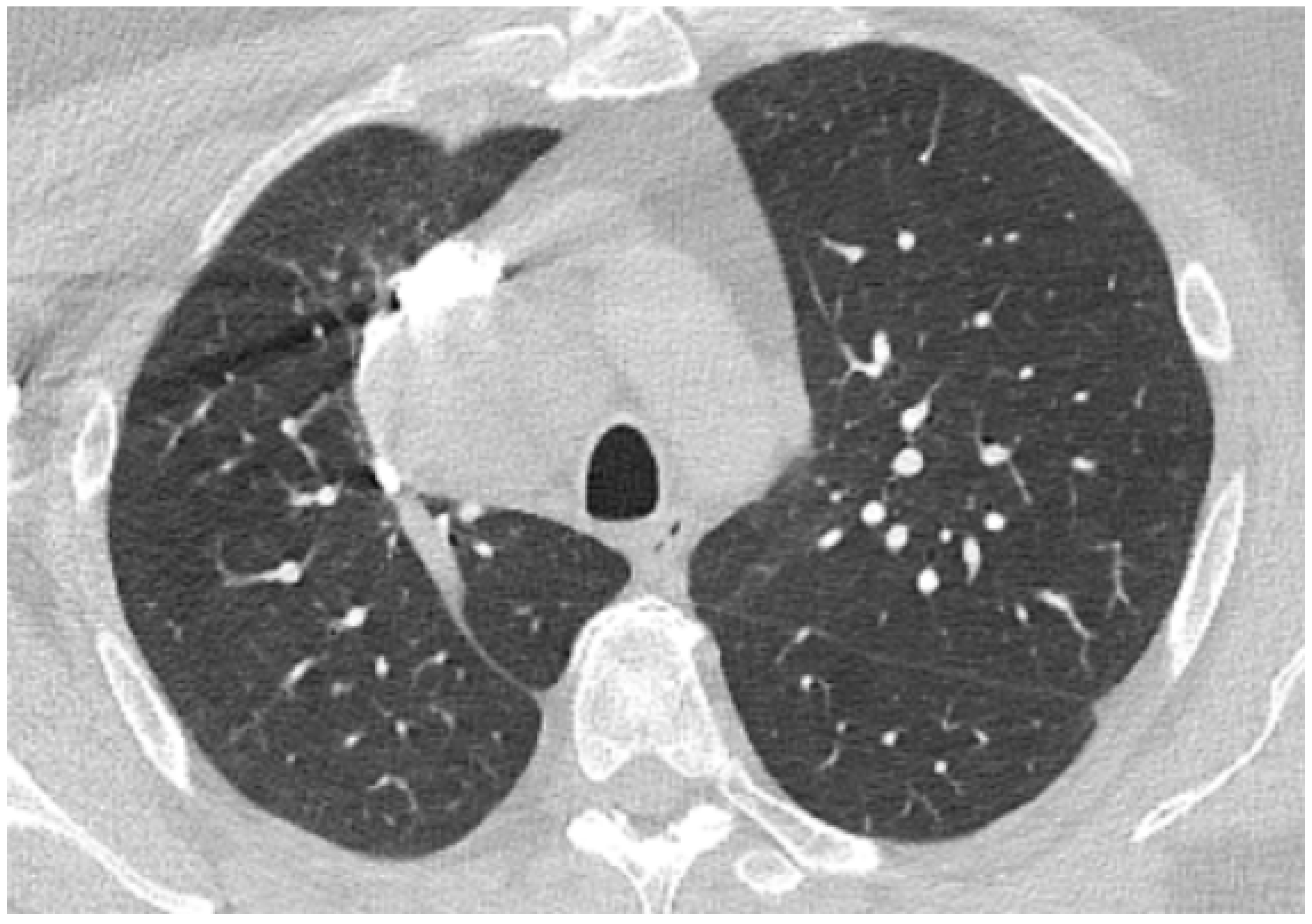Biomedicines 11 00095 g005