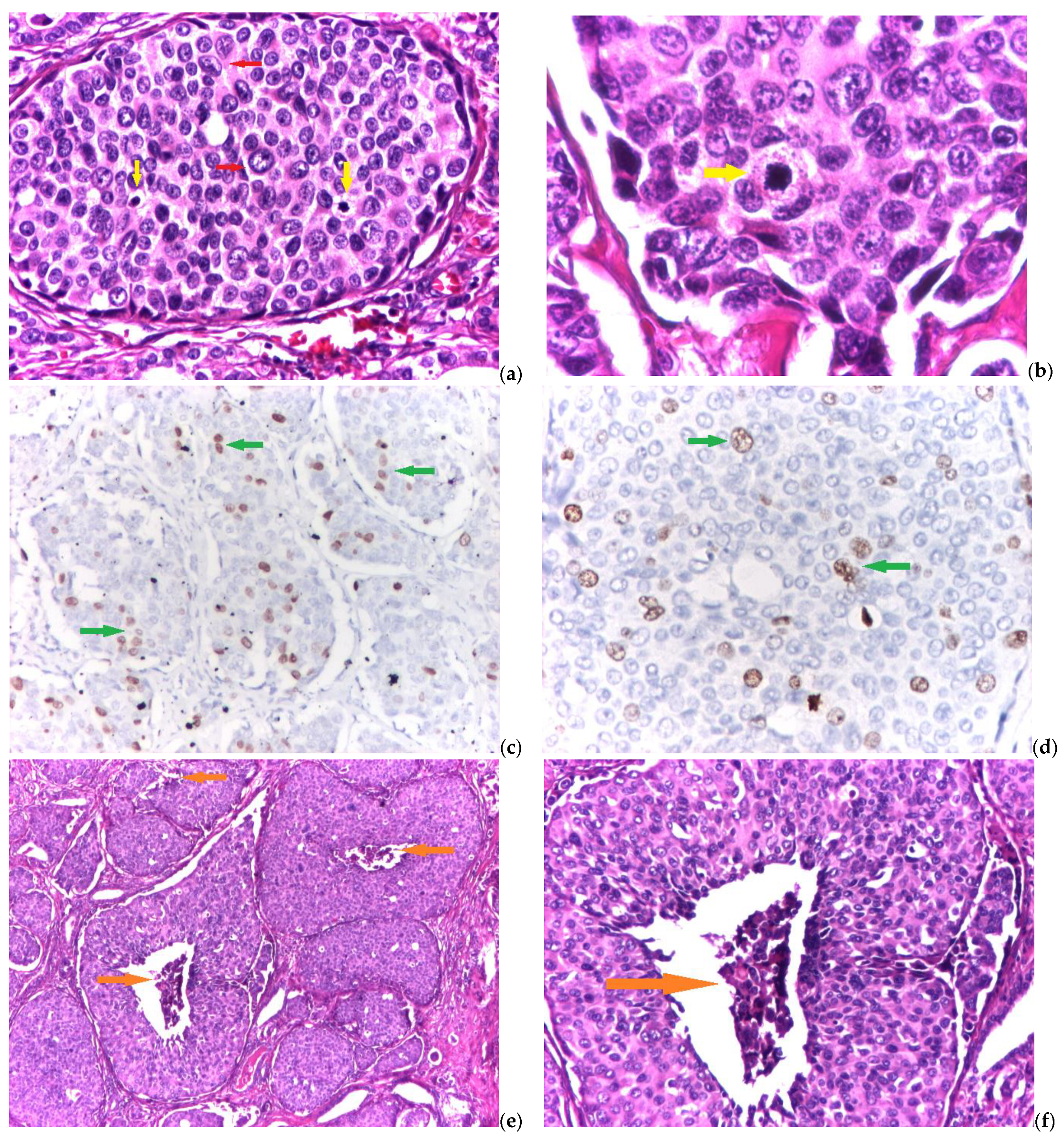 Biomedicines 11 00116 g002 Biomedicines 11 00116 g002