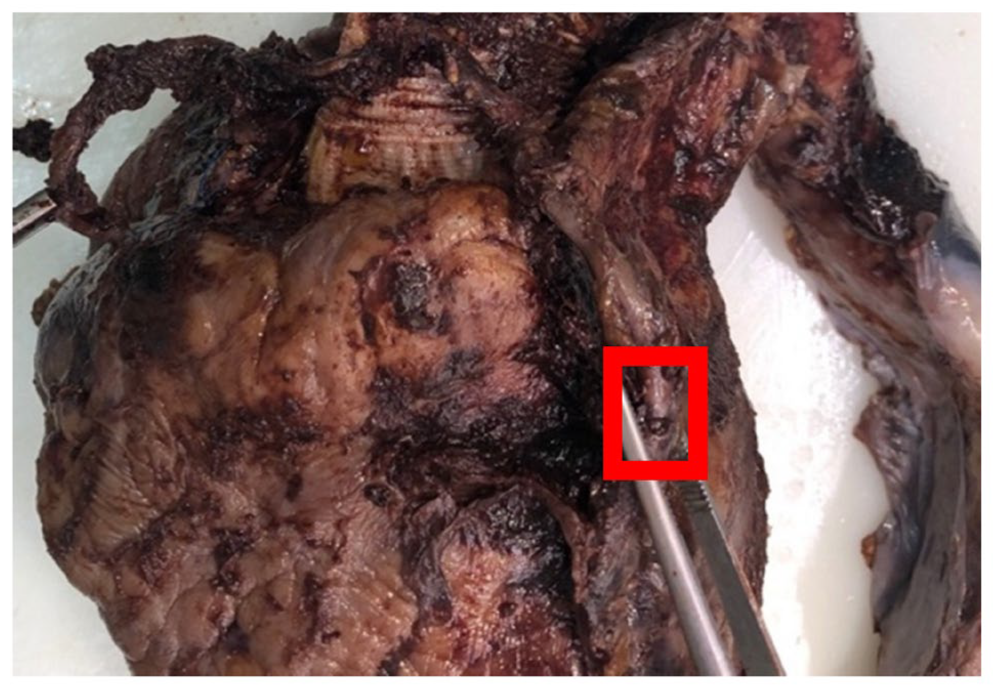 Biomedicines 11 00220 g001